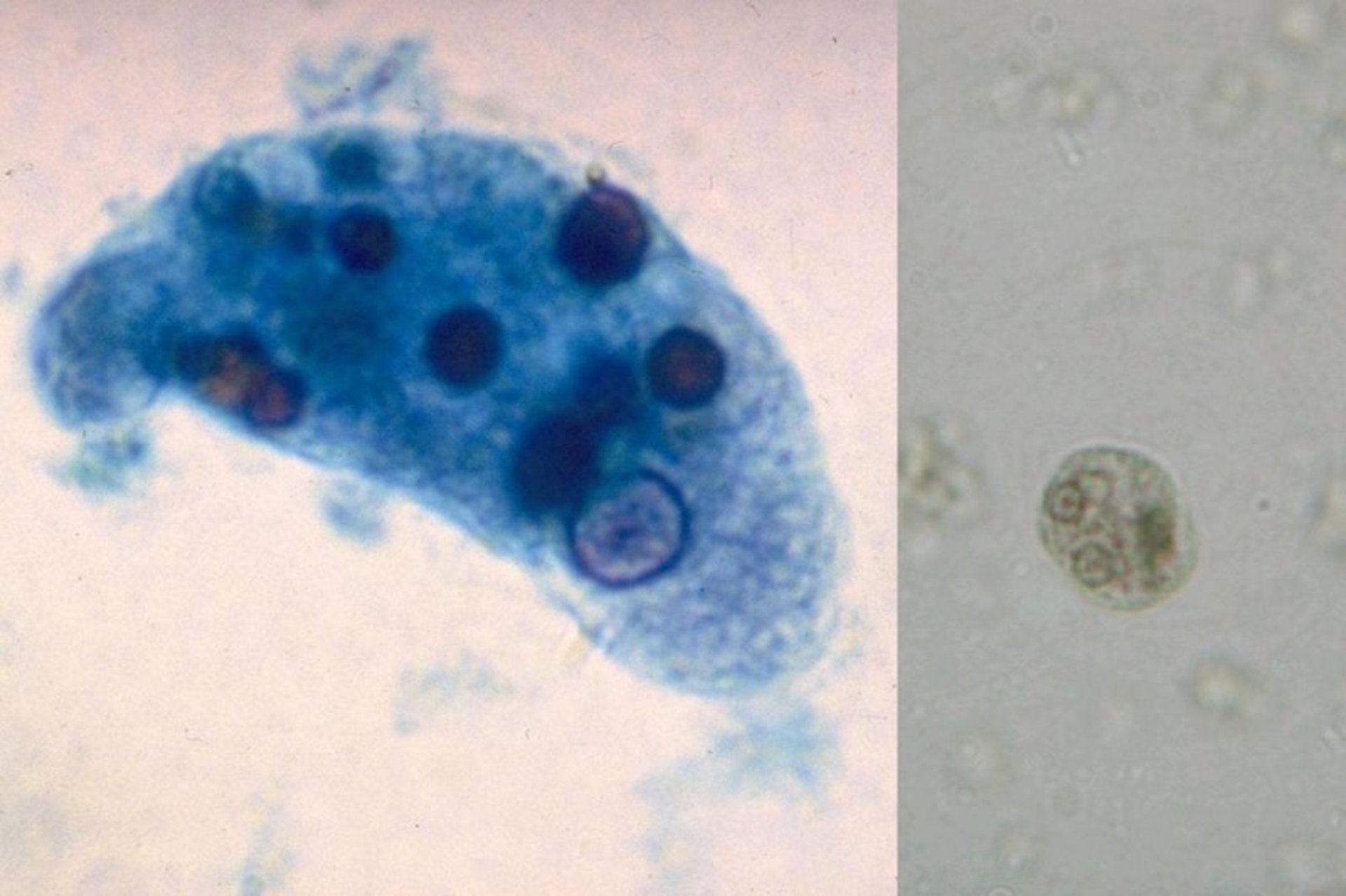 <i >Entamoeba invadens</i>, trofozoíto y quiste en heces, microfotografías