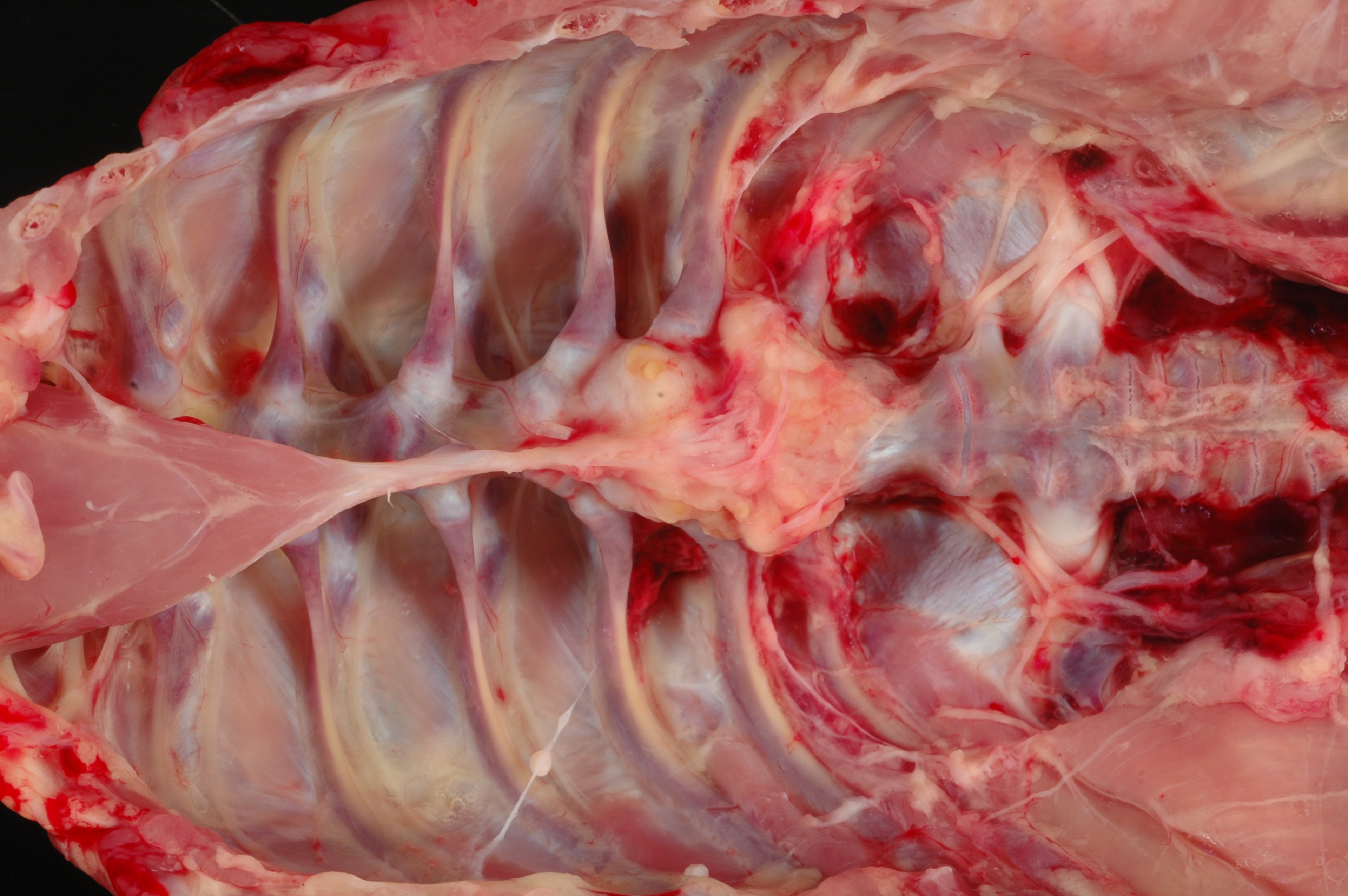 Espondilitis enterocócica, pollo de engorde de 43 días de edad