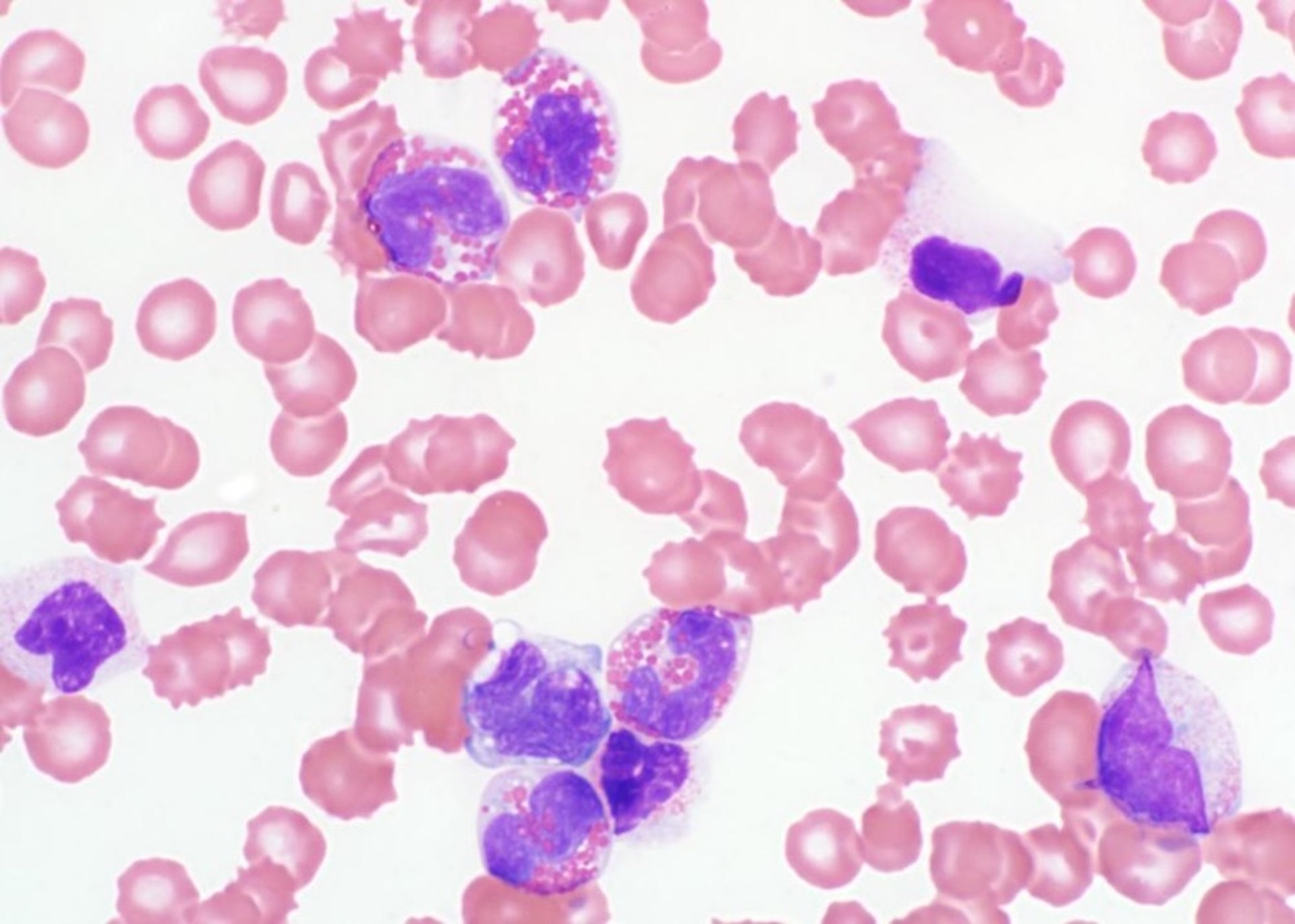 Eosinophilia, blood smear, dog