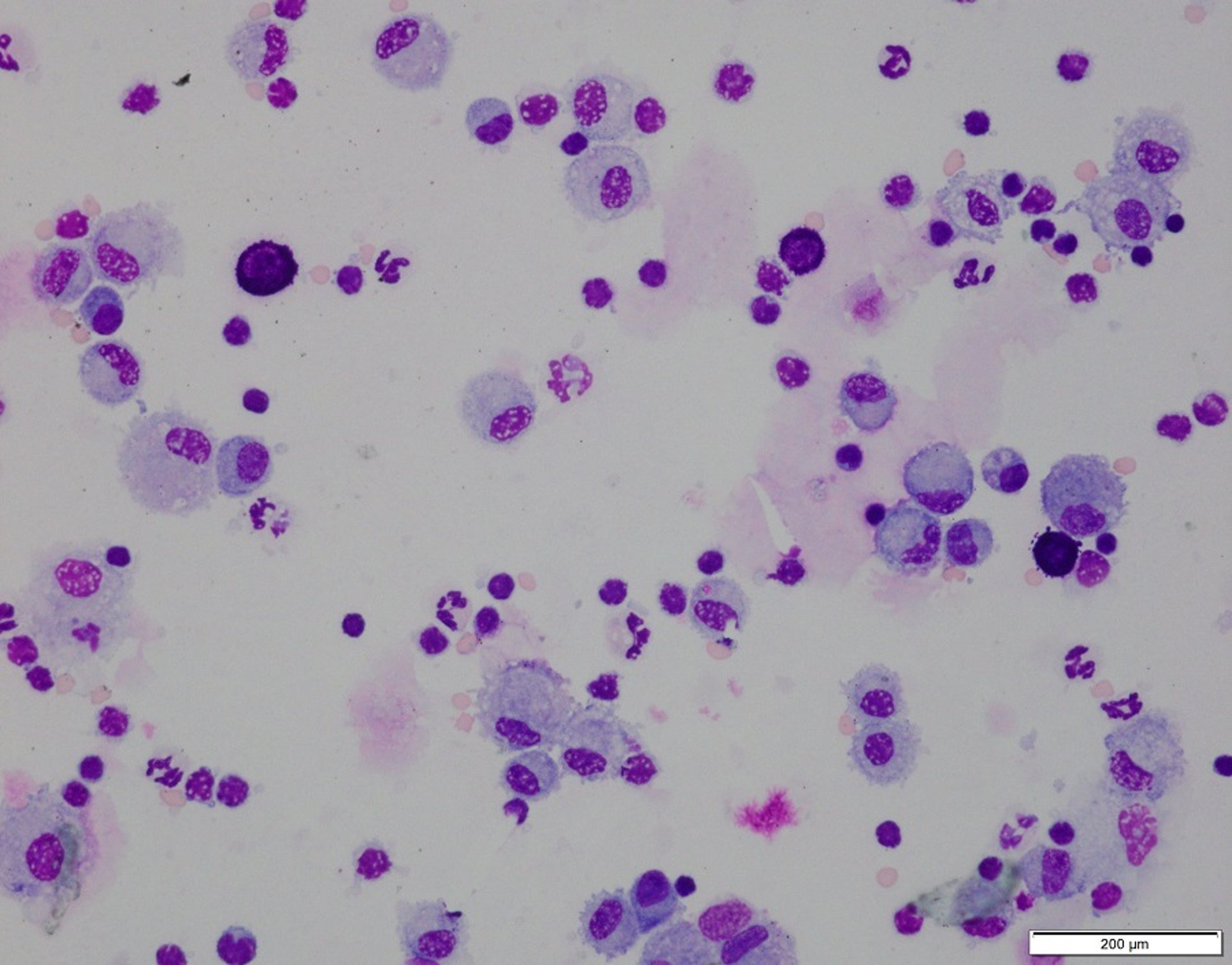 Bronchoalveolar lavage, neutrophilic inflammation, horse