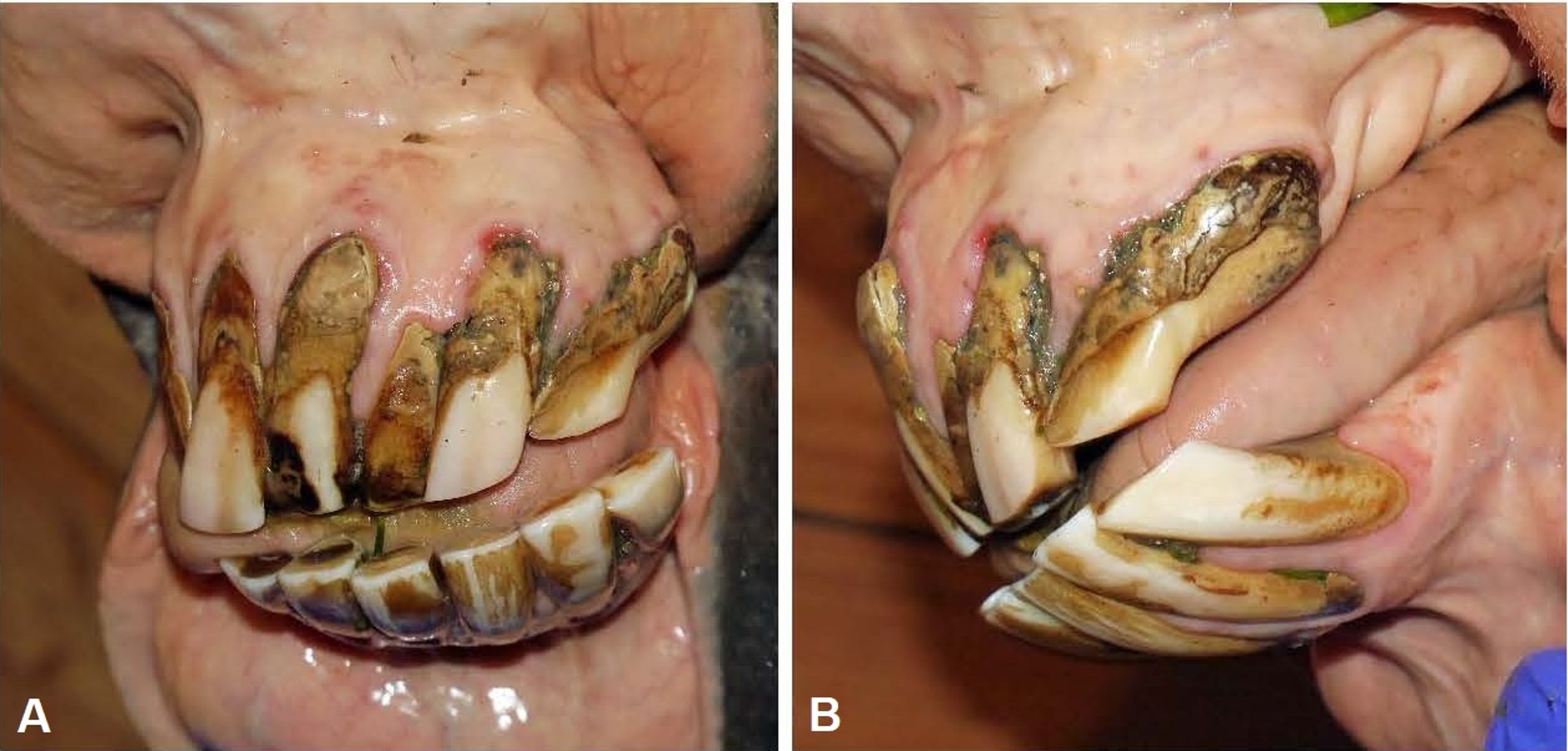 Equine odontoclastic tooth resorption and hypercementosis