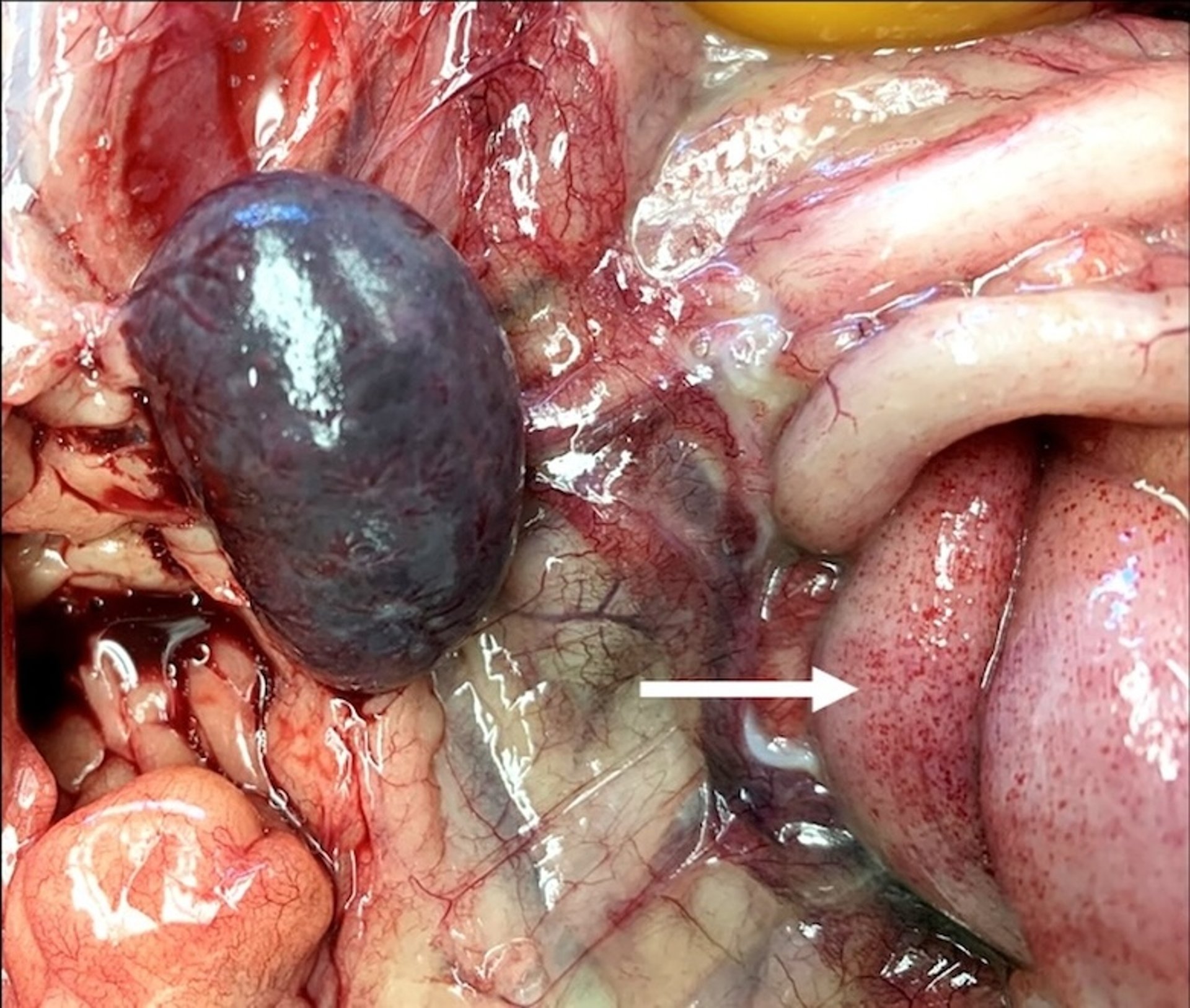 Erysipelas infection with petechial hemorrhages, spleen, turkey