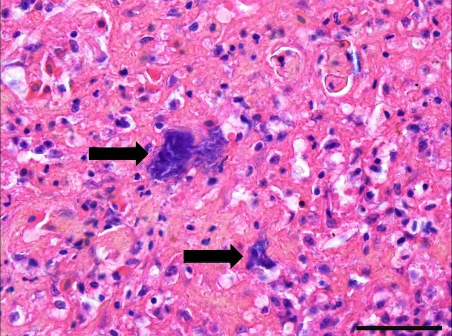 <i >Erysipelothrix rhusiopathiae</i>, bacterial colonies, turkey