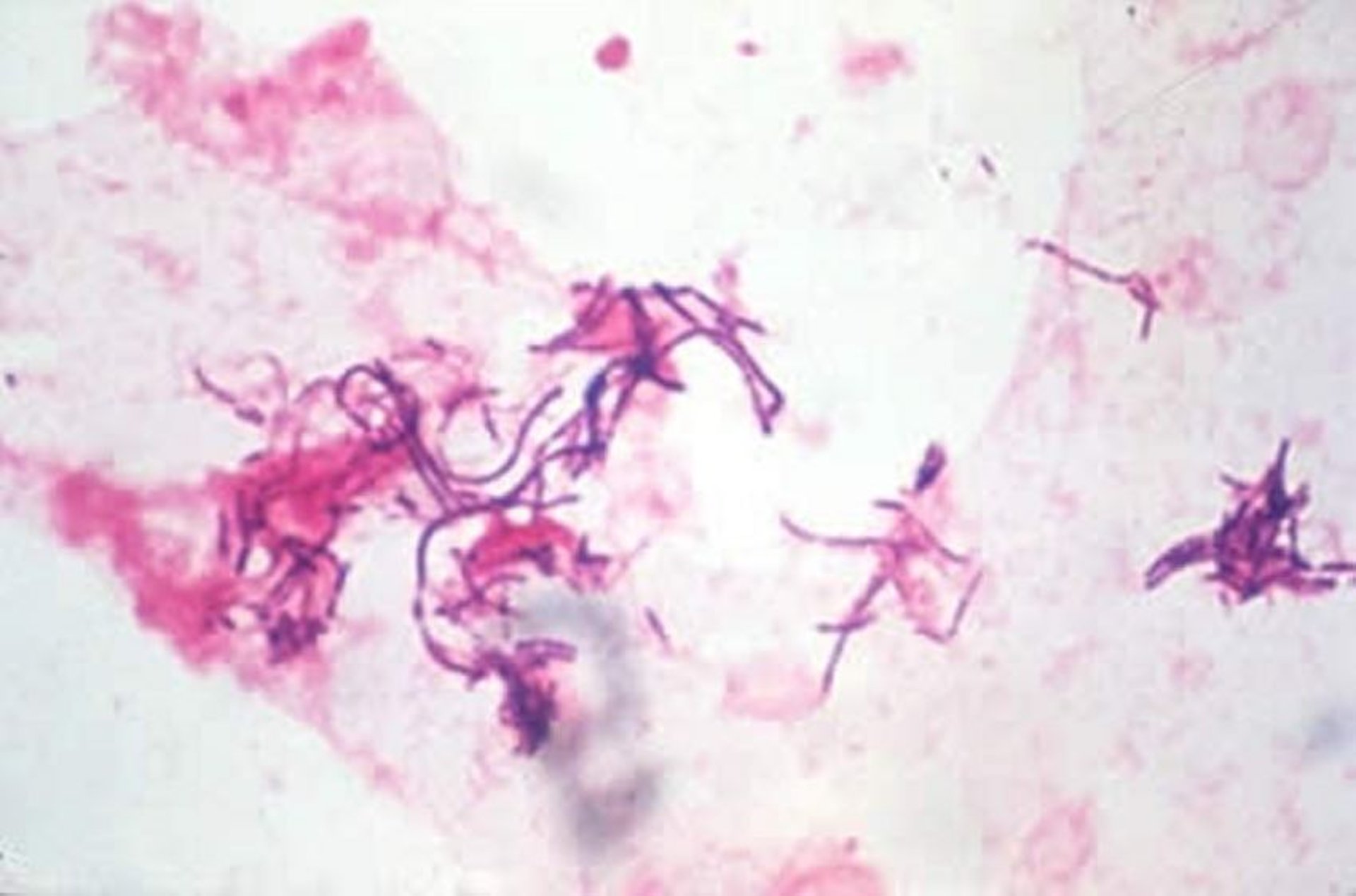<i >Erysipelothrix rhusiopathiae</i>, endocarditis, microfotografía