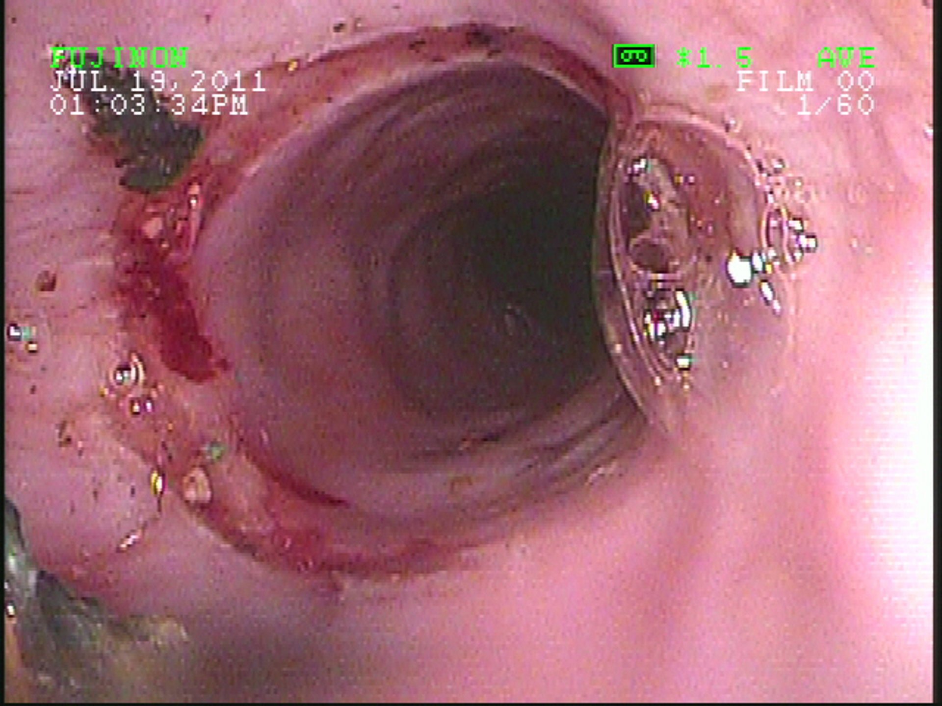 Endoscopia esofágica, caballo