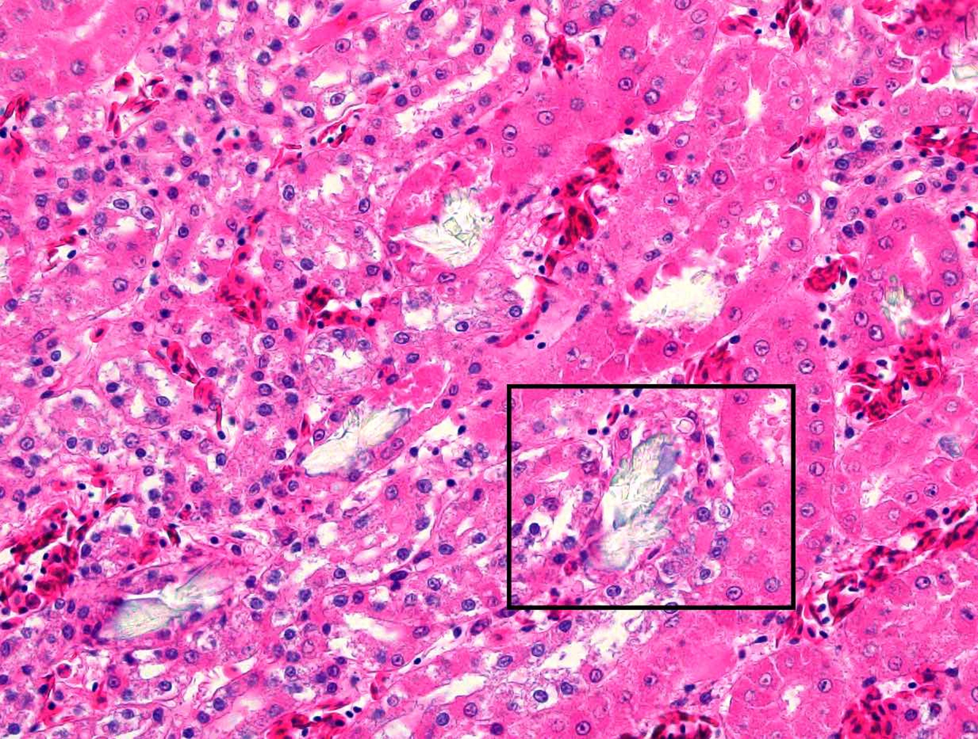 Ethylene glycol poisoning, chicken