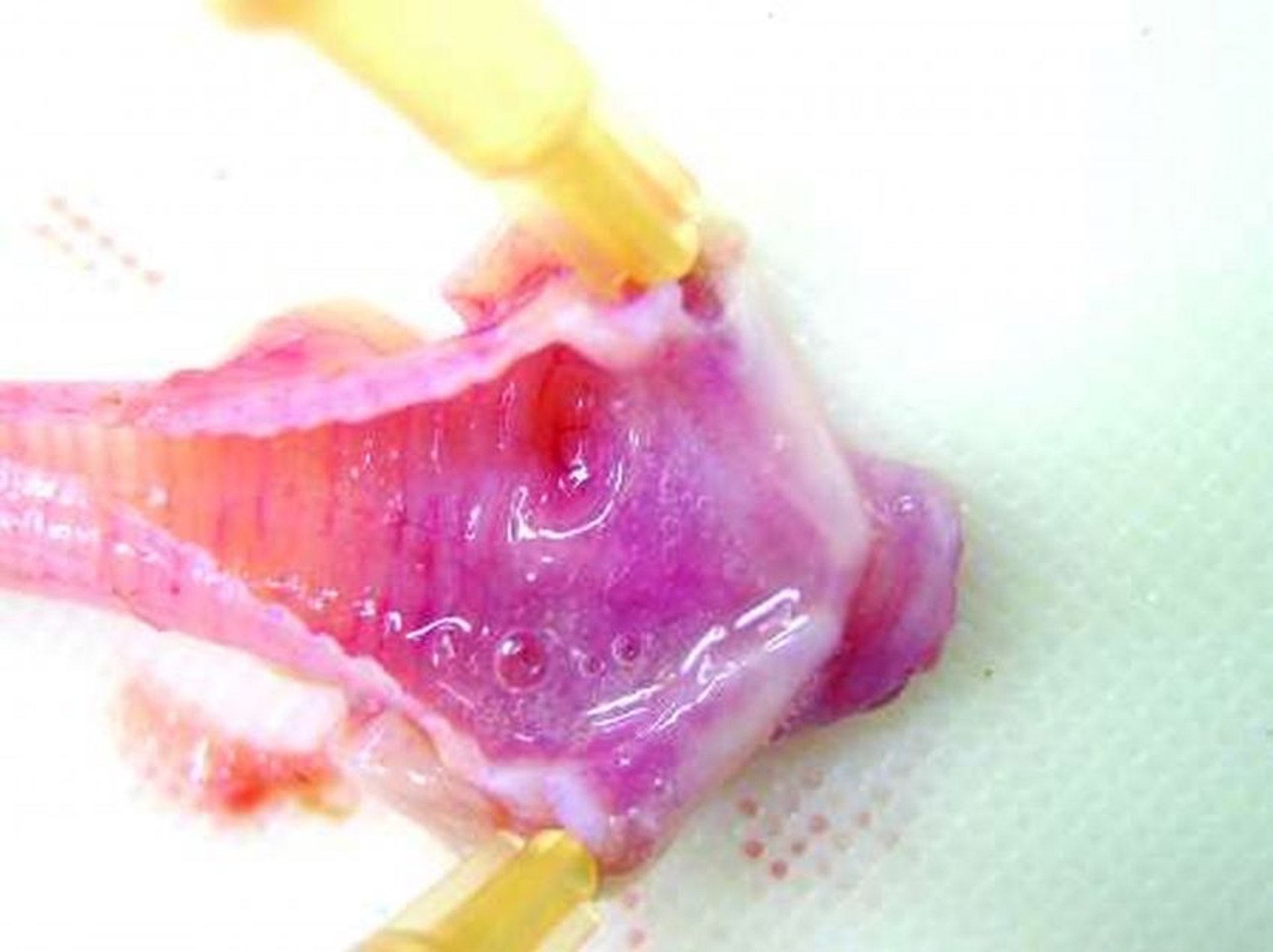 Excessive mucus in trachea, chicken