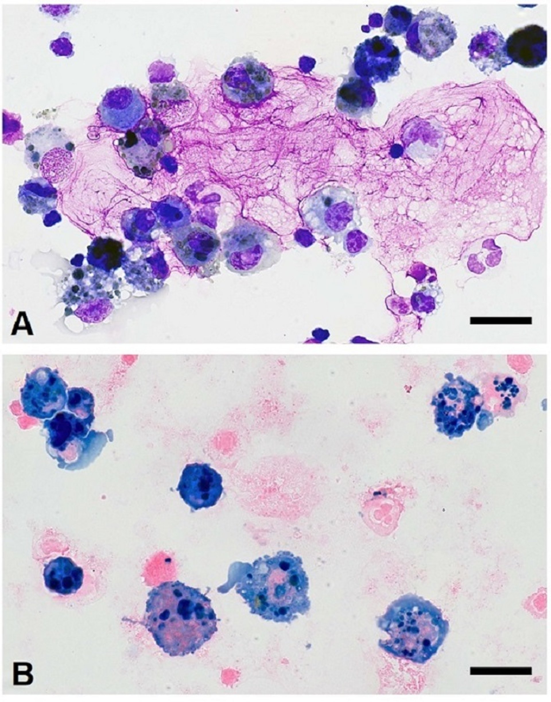 Exercise-induced pulmonary hemorrhage, horse