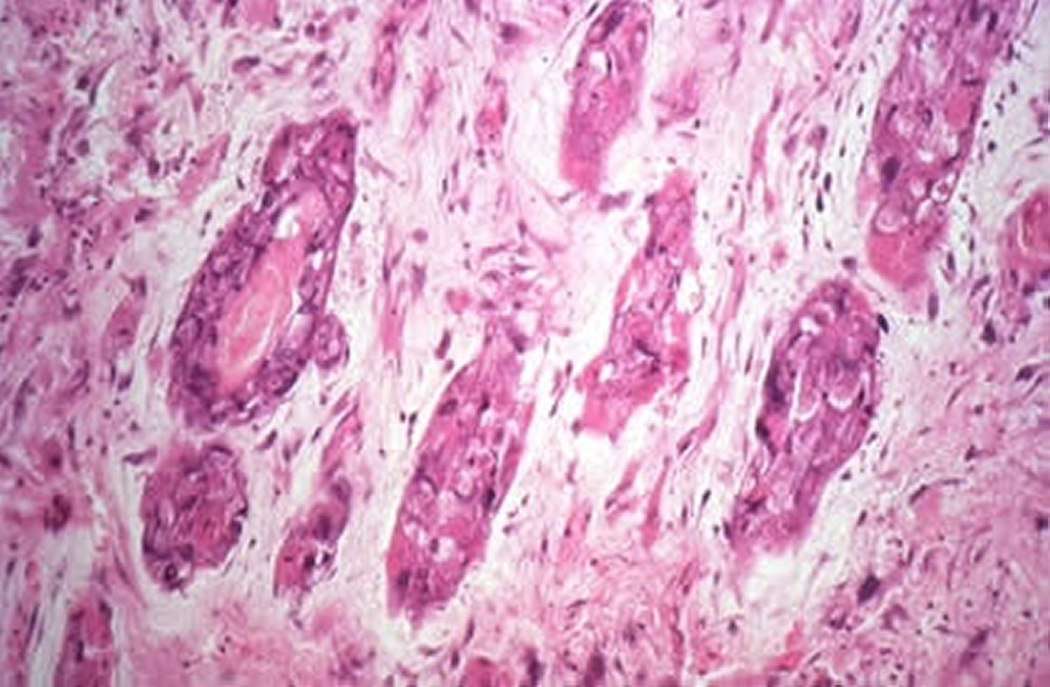 Mixomatosis, conejo