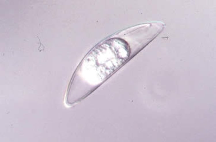 Huevo de <i >Syphacia muris</i>