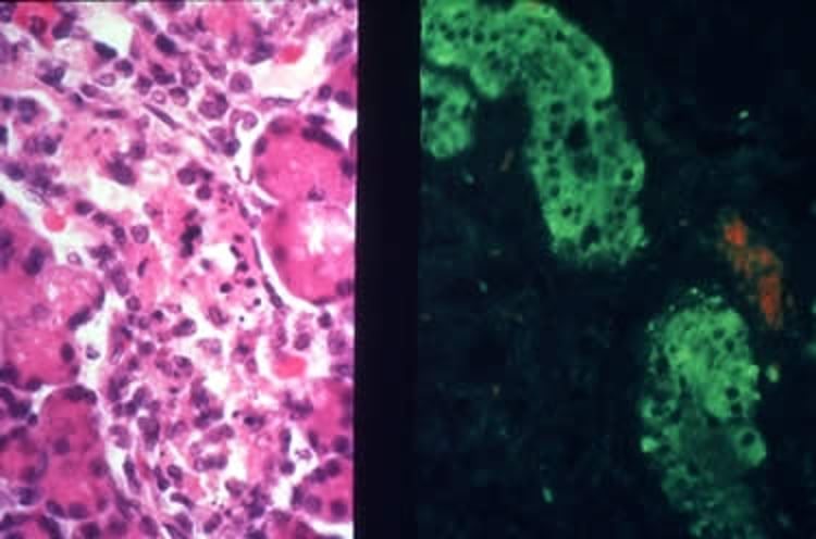 Destrucción de células epiteliales ductales, glándula salival parótida, rata