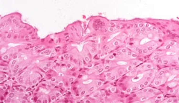Virus de la hepatitis del ratón, sincitios en el epitelio intestinal, ratón