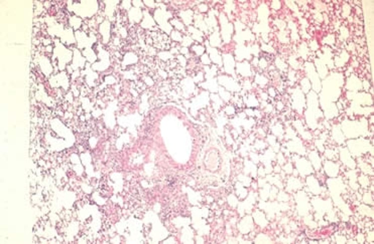 Virus de Sendai, inflamación peribronquiolar, rata