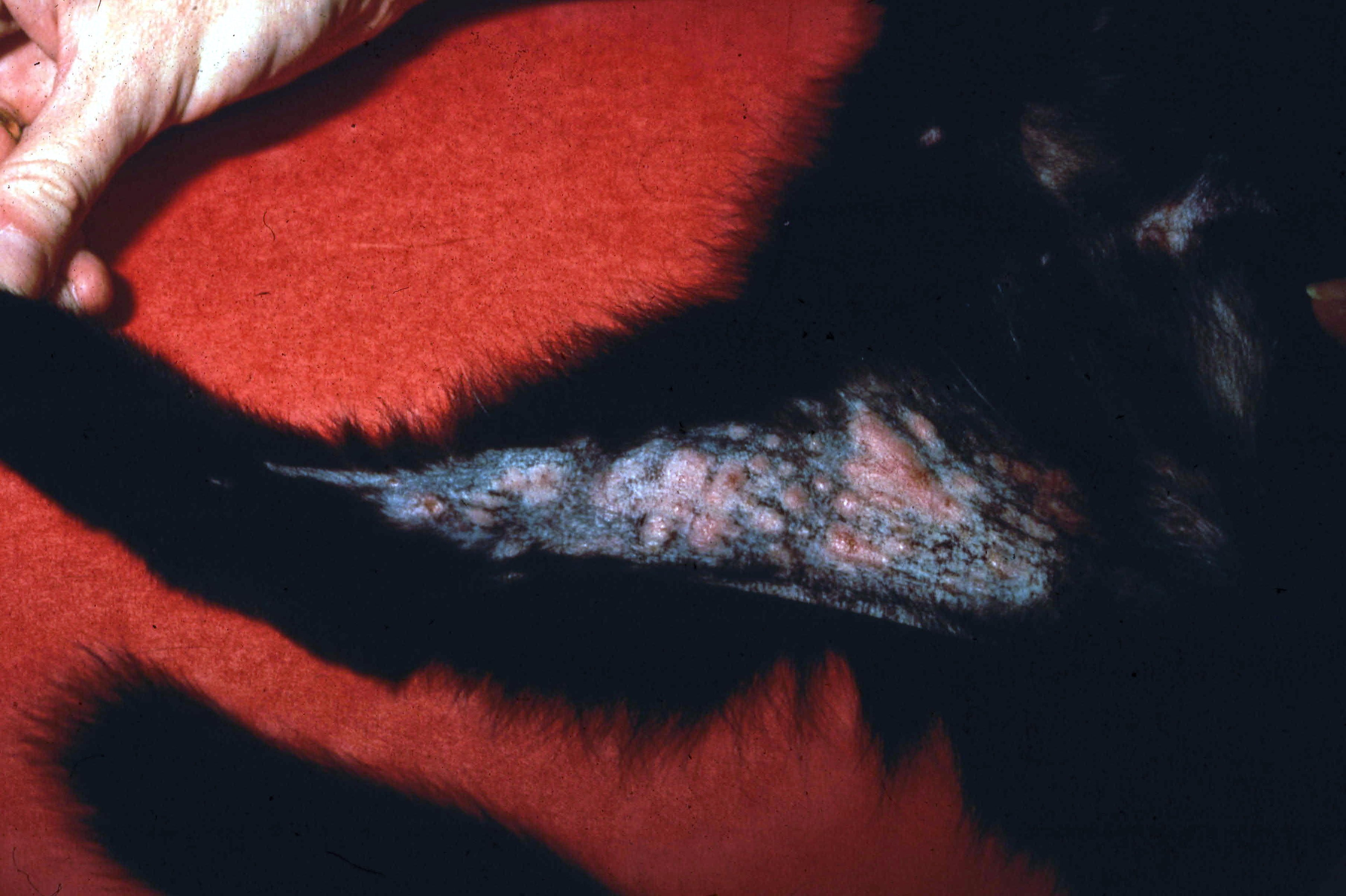 Lesiones eosinofílicas exudativas