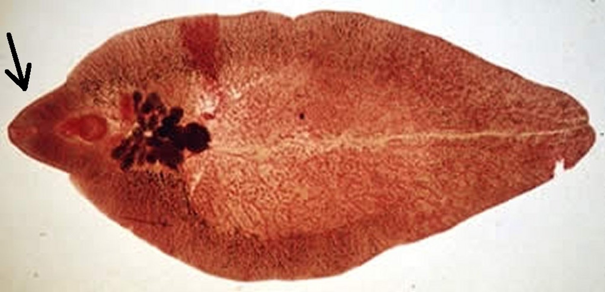 <i >Fasciola hepatica</i>, adult