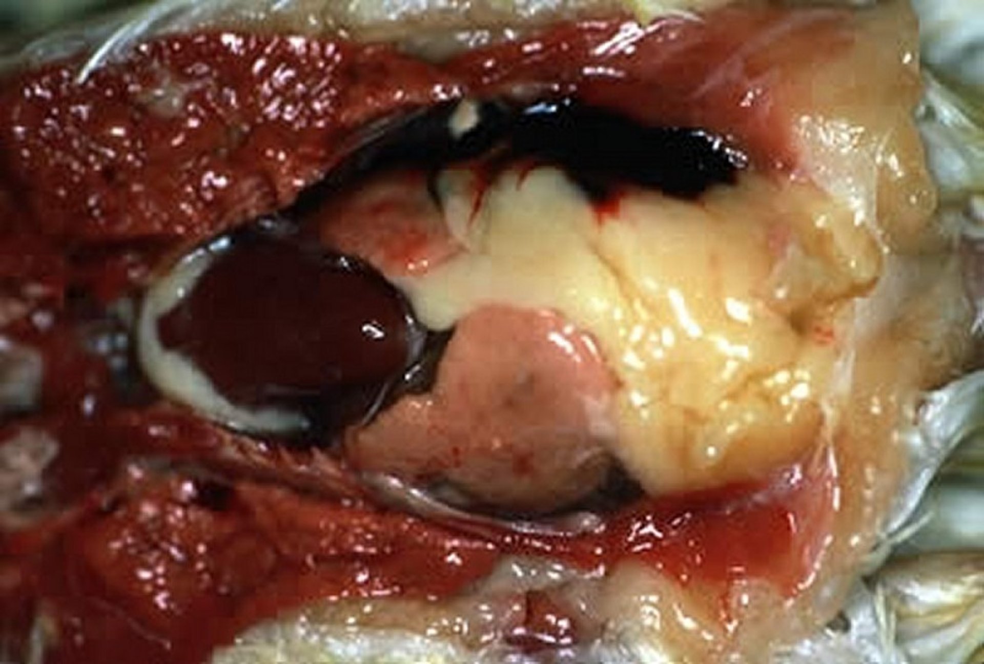 Fatty liver disease, gross lesions, cockatiel