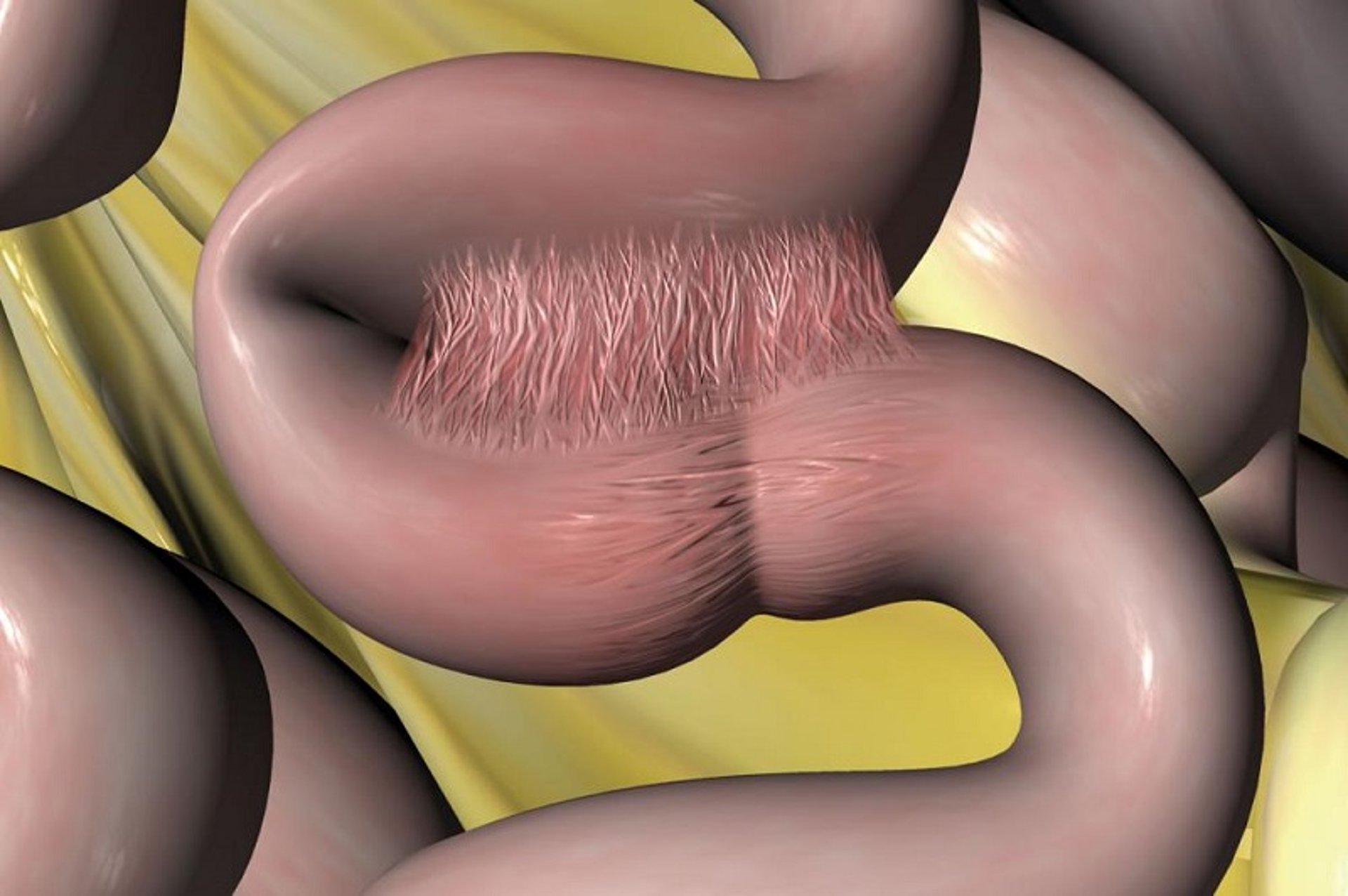 Fibrous adhesion, horse