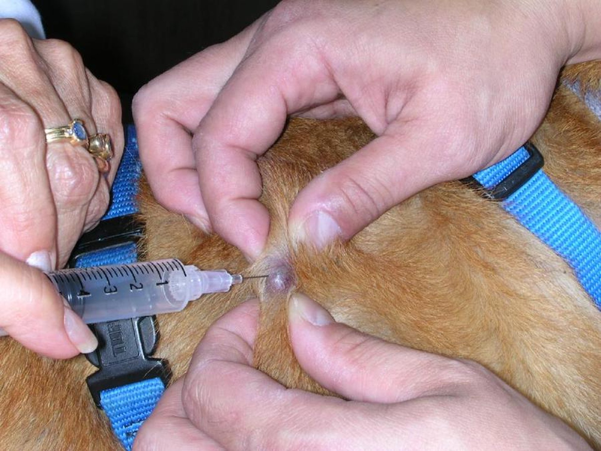Fine-needle aspiration of a skin mass