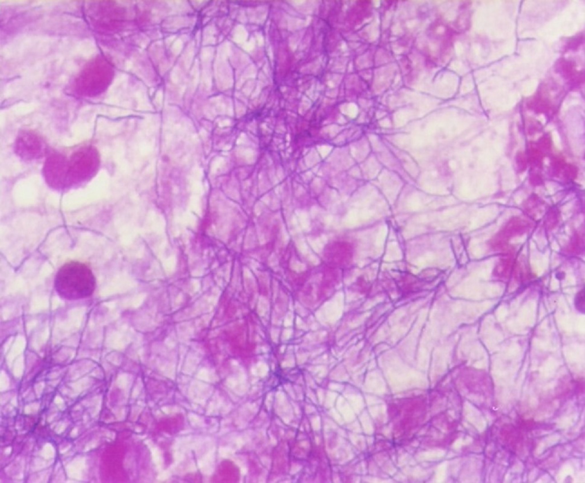 Fine-needle aspirate, dog