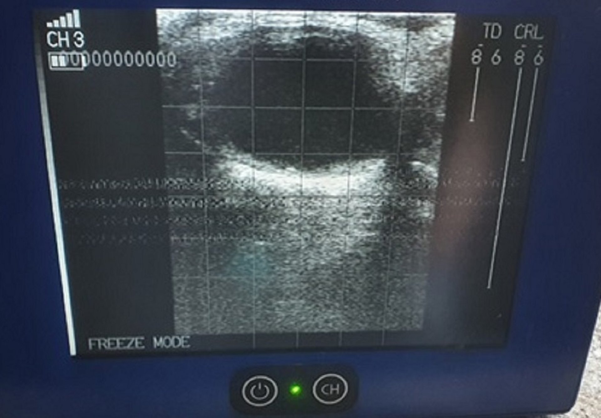 Follicular cyst > 40 mm, ultrasonographic image, cow