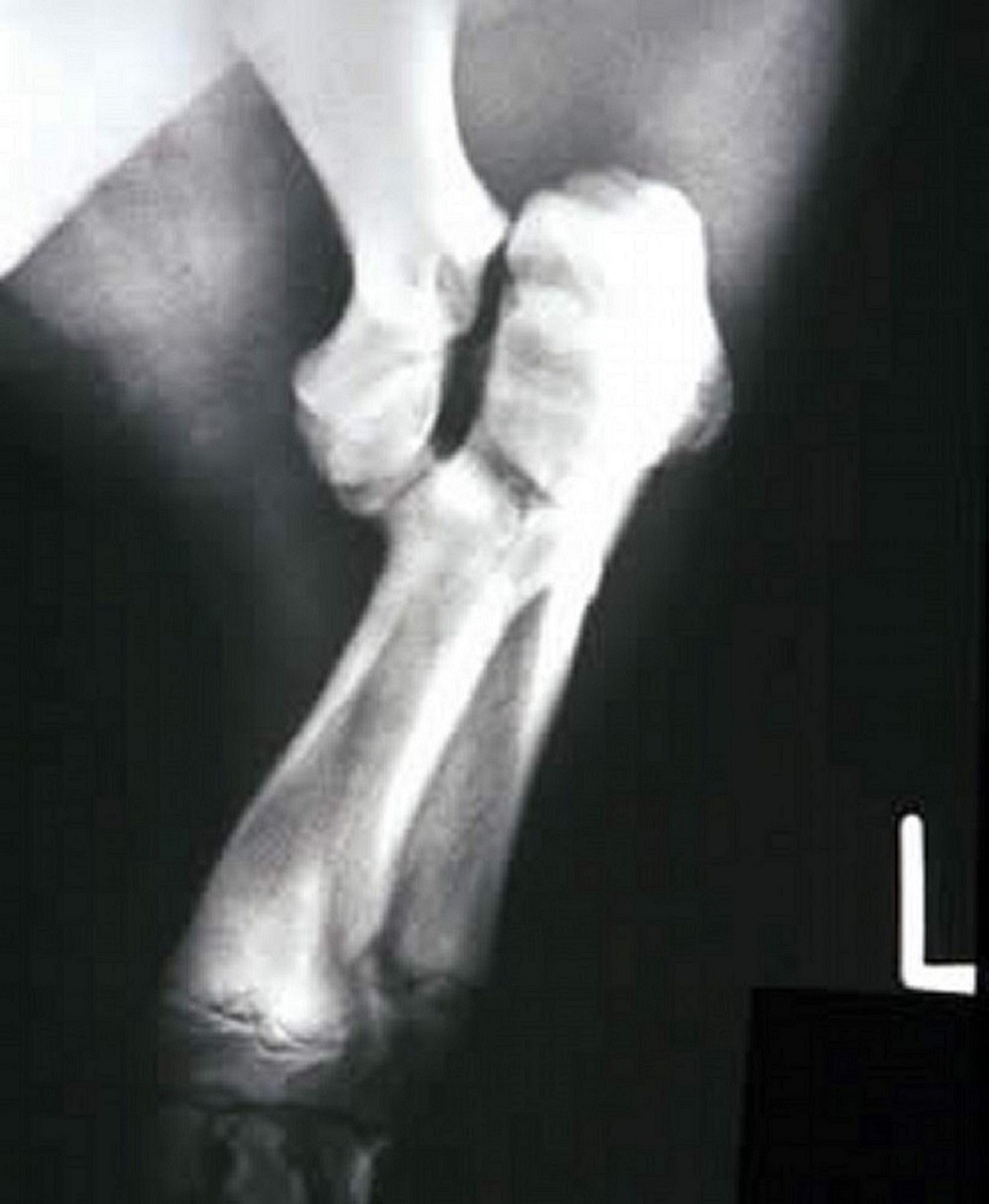 Fracture, left distal humeral condyle, miniature pig