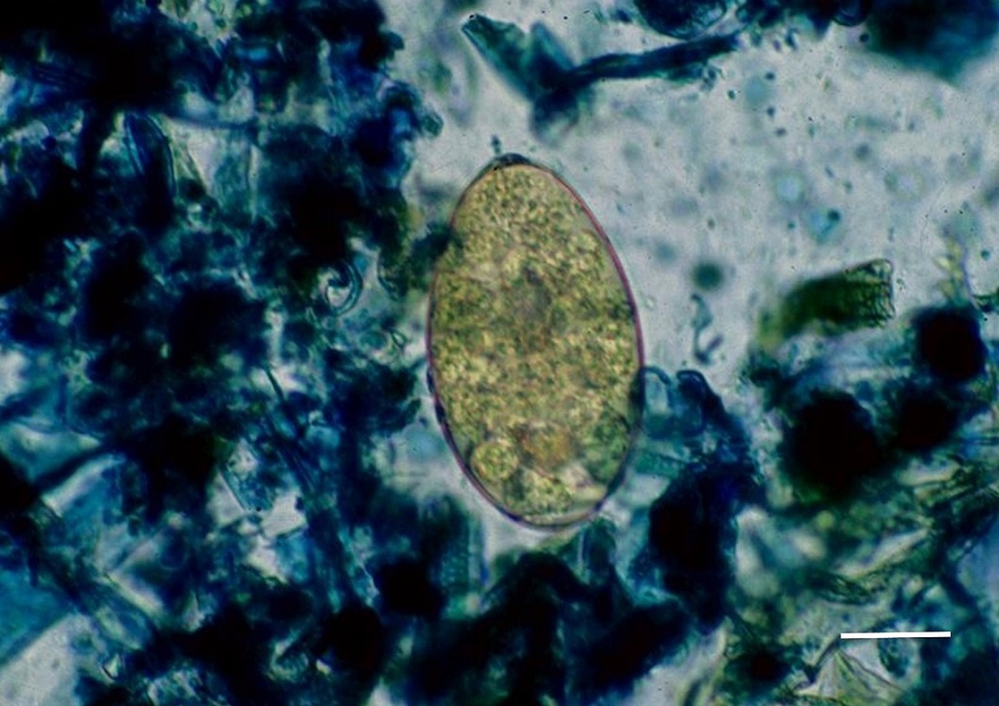 Huevo de <i >Fasciola hepatica</i>