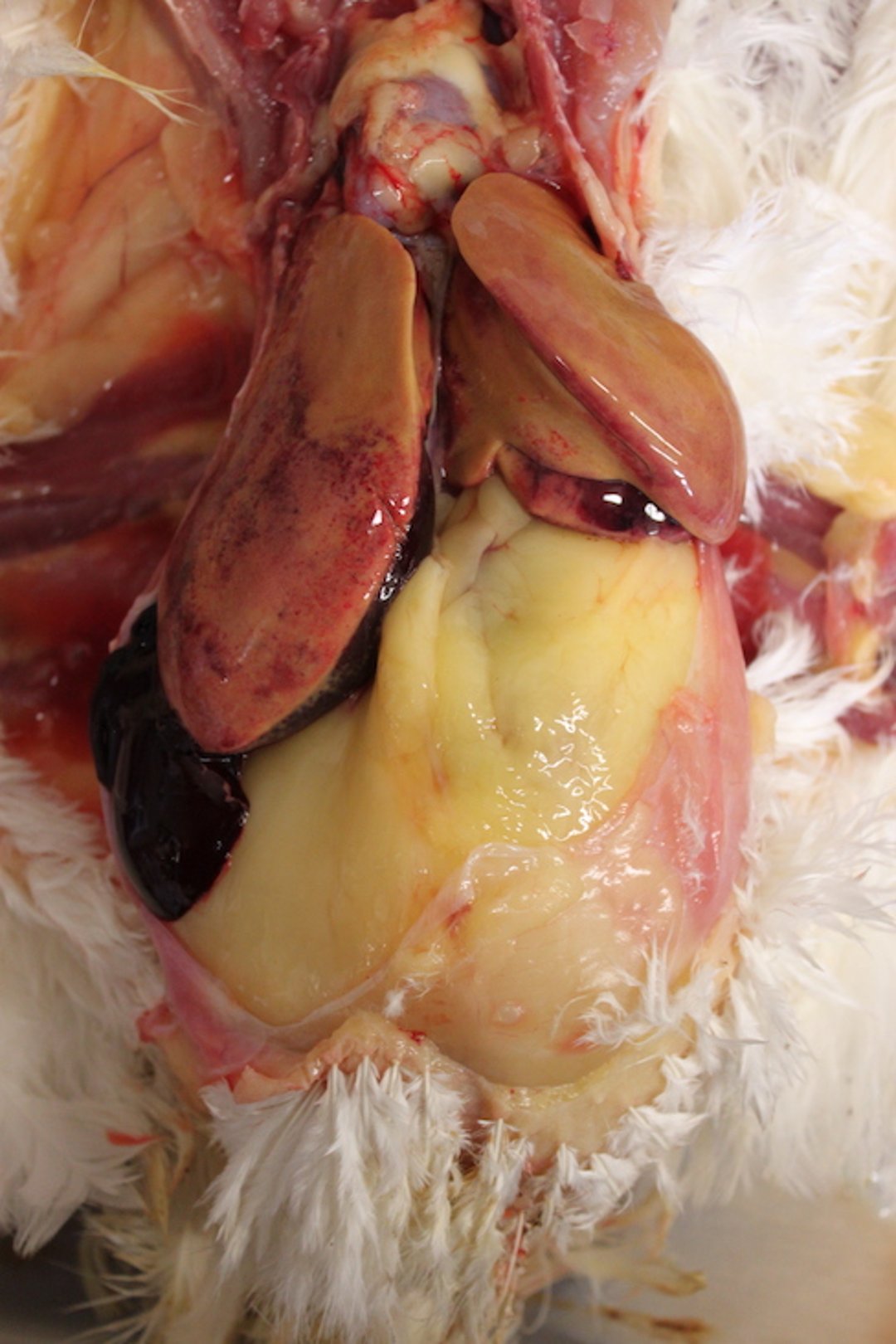 Fatty liver hemorrhagic syndrome, chicken