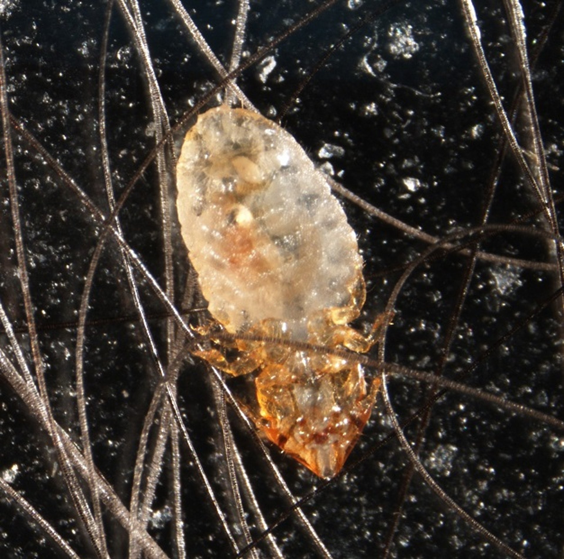 <i >Felicola subrostratus</i>, micrografía