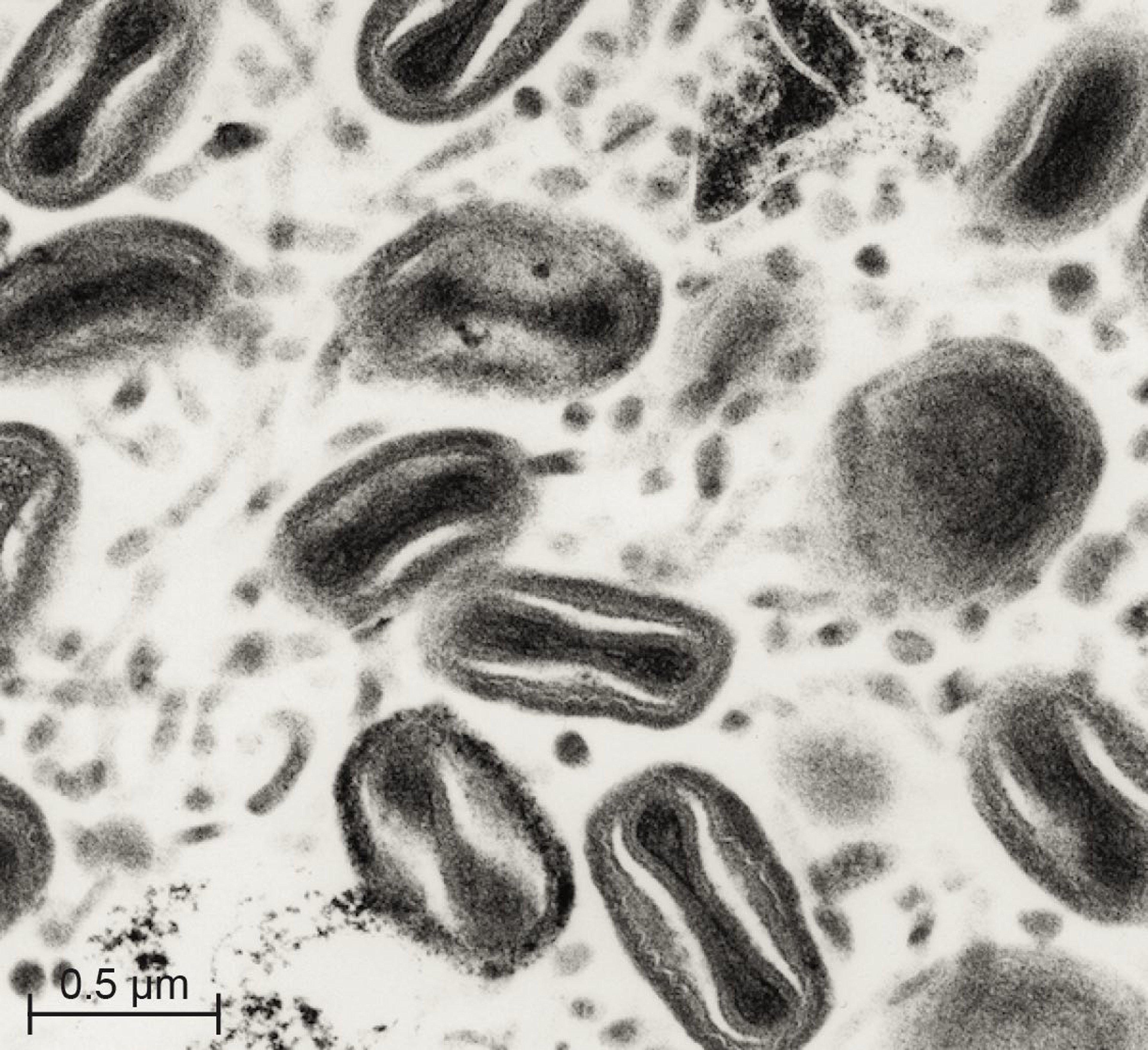 Fowlpox virus lesion
