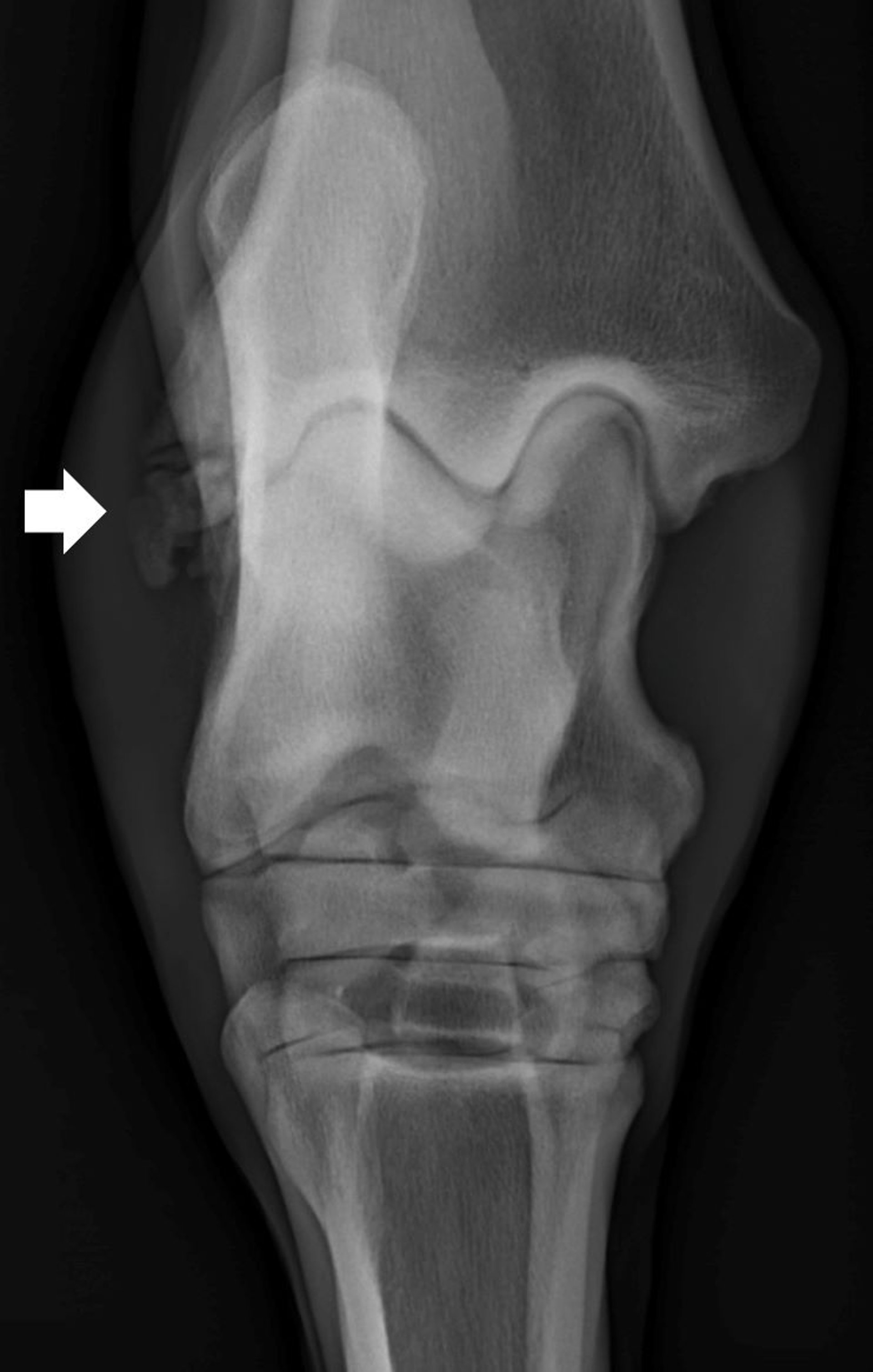 Fratura, maléolo lateral da tíbia, radiografia, equino
