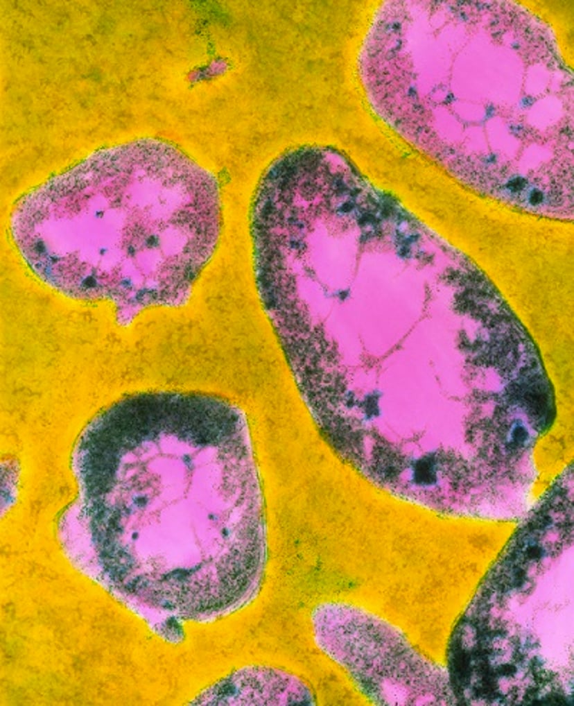 Bacteria <i >Francisella tularensis</i>, microfotografía