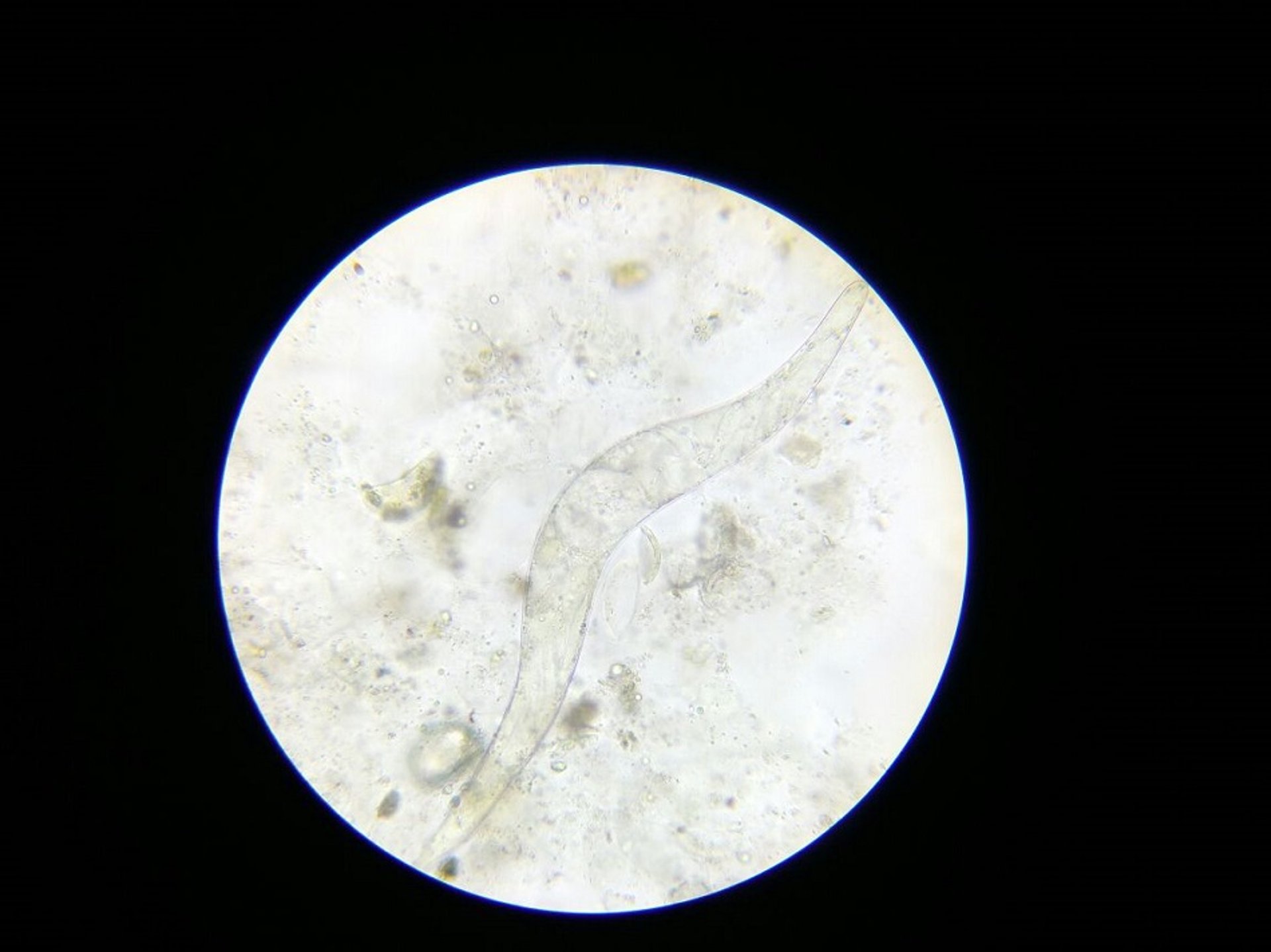 Miracidio