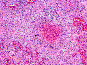 Fungal granuloma, aspergillosis, turkey poult