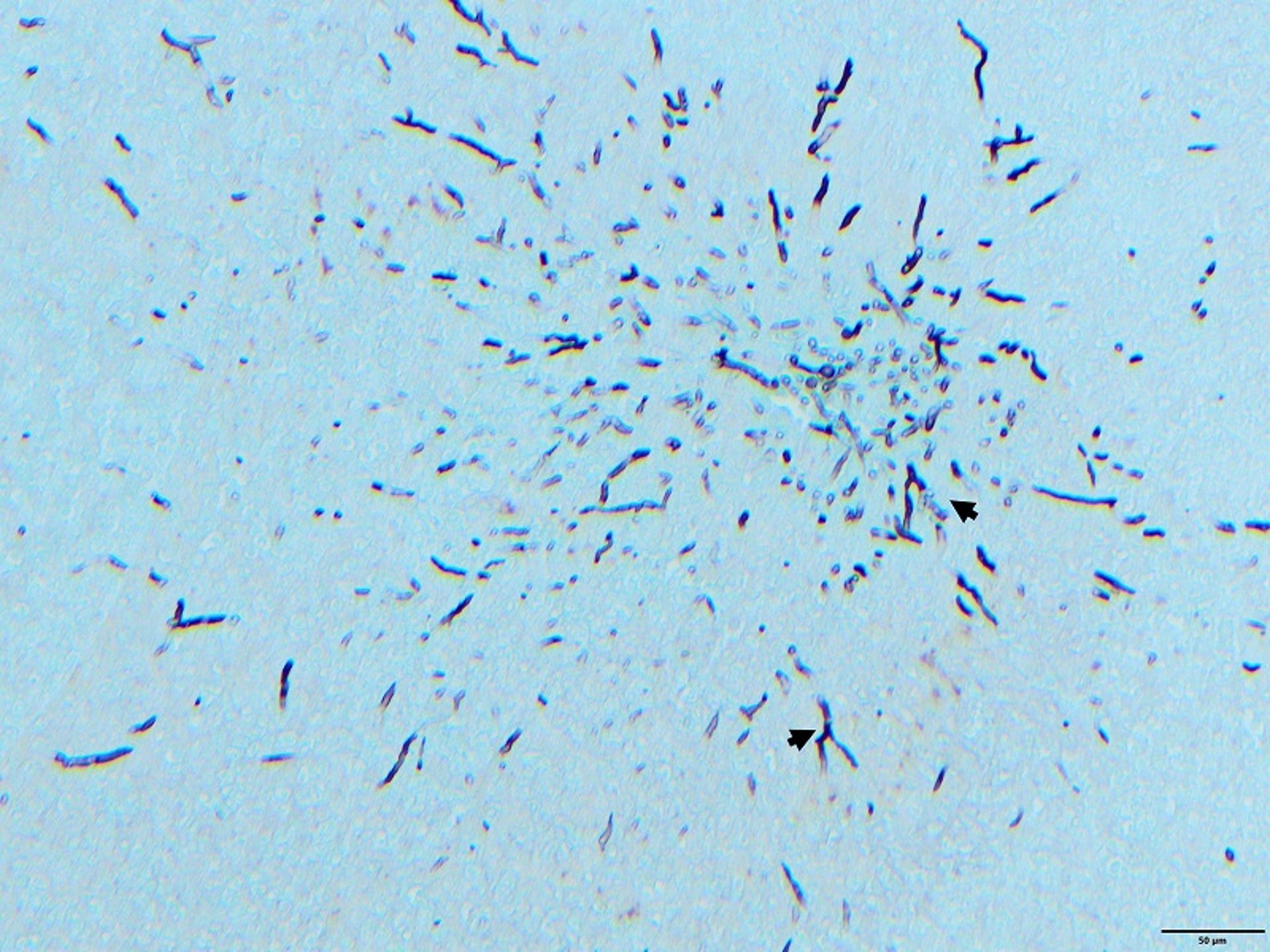 Fungal hyphae (brain), aspergillosis, turkey poult