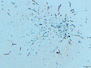 Fungal hyphae (brain), aspergillosis, turkey poult