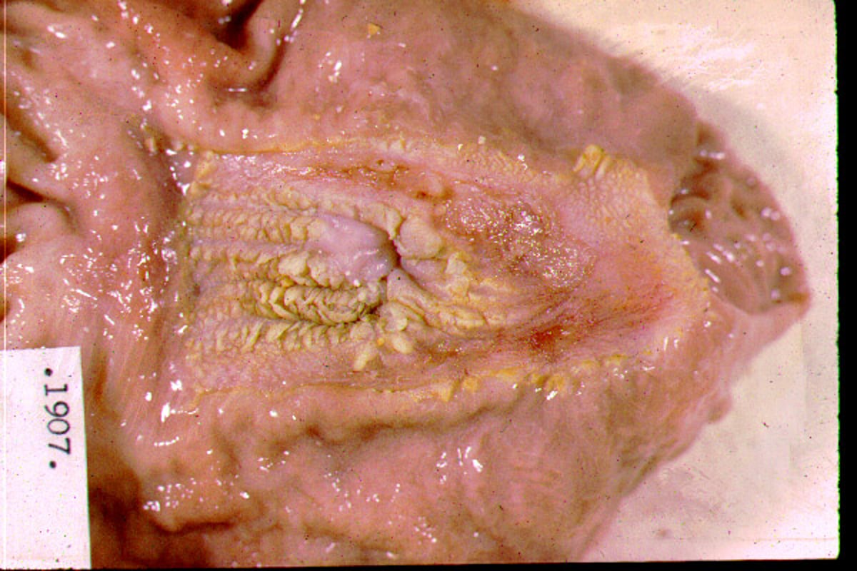 Gastric ulcer, pig