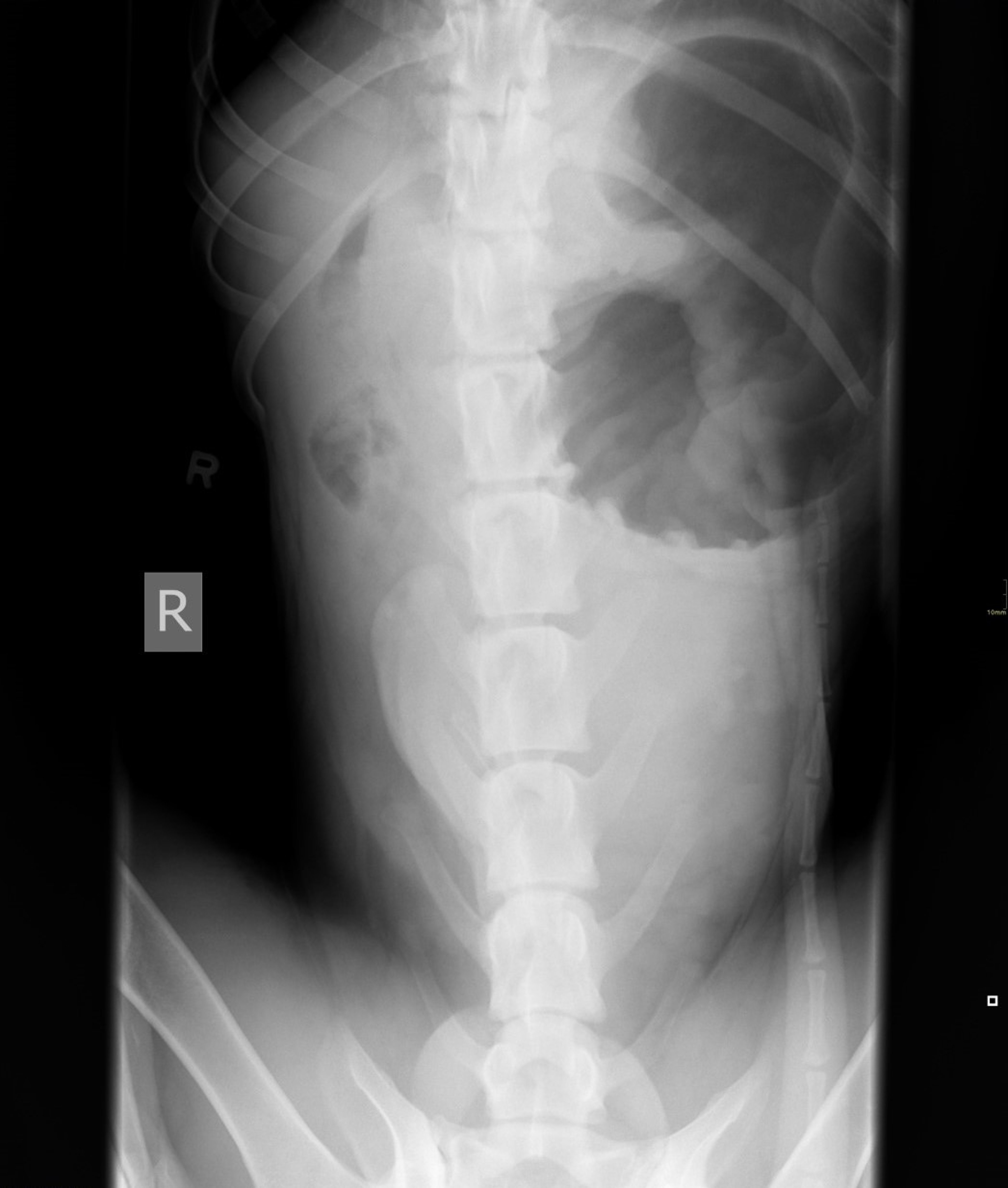 Gastric dilation and volvulus, dog, ventrodorsal view