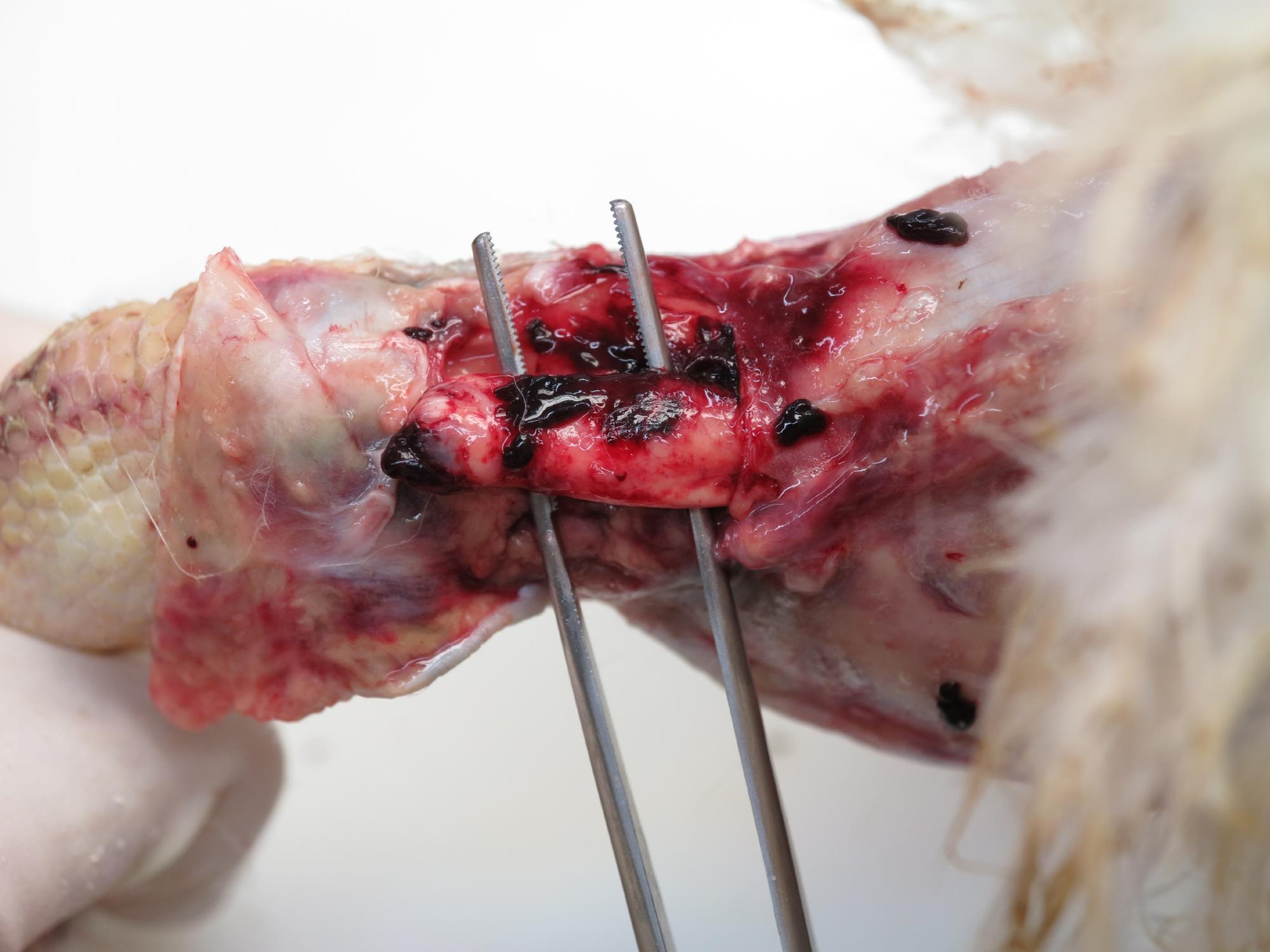 Gastrocnemius tendon rupture, 33-week-old broiler breeder