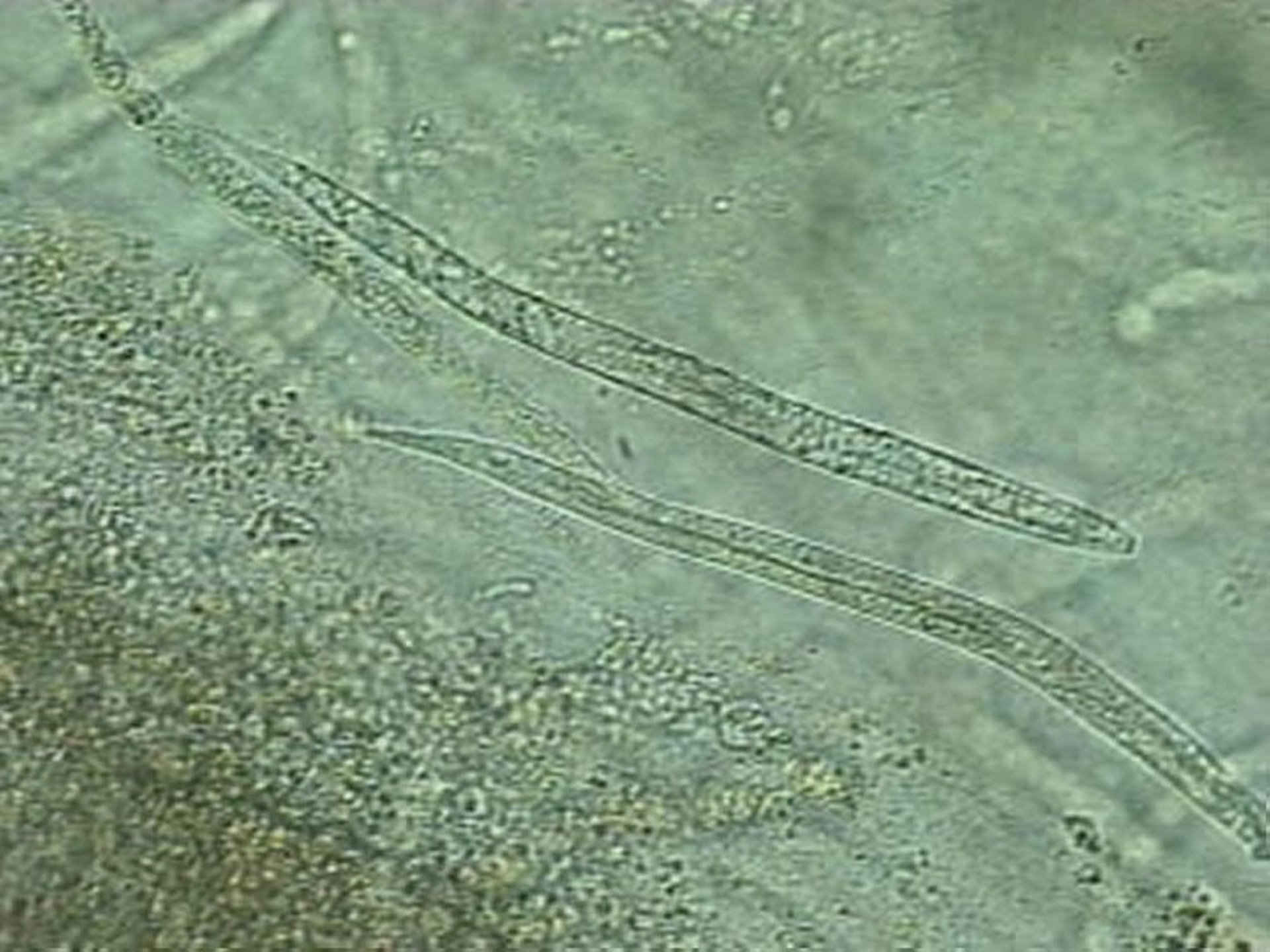 Gastrointestinal nematode, amphibian