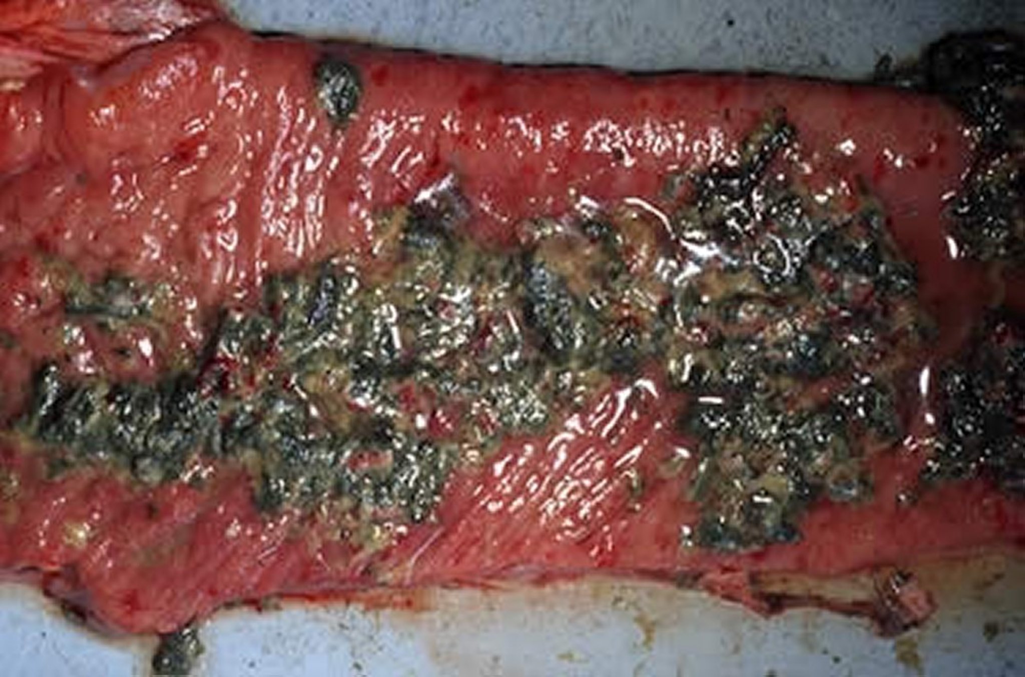 Rinderpest, necrosis and fibronecrotic exudate