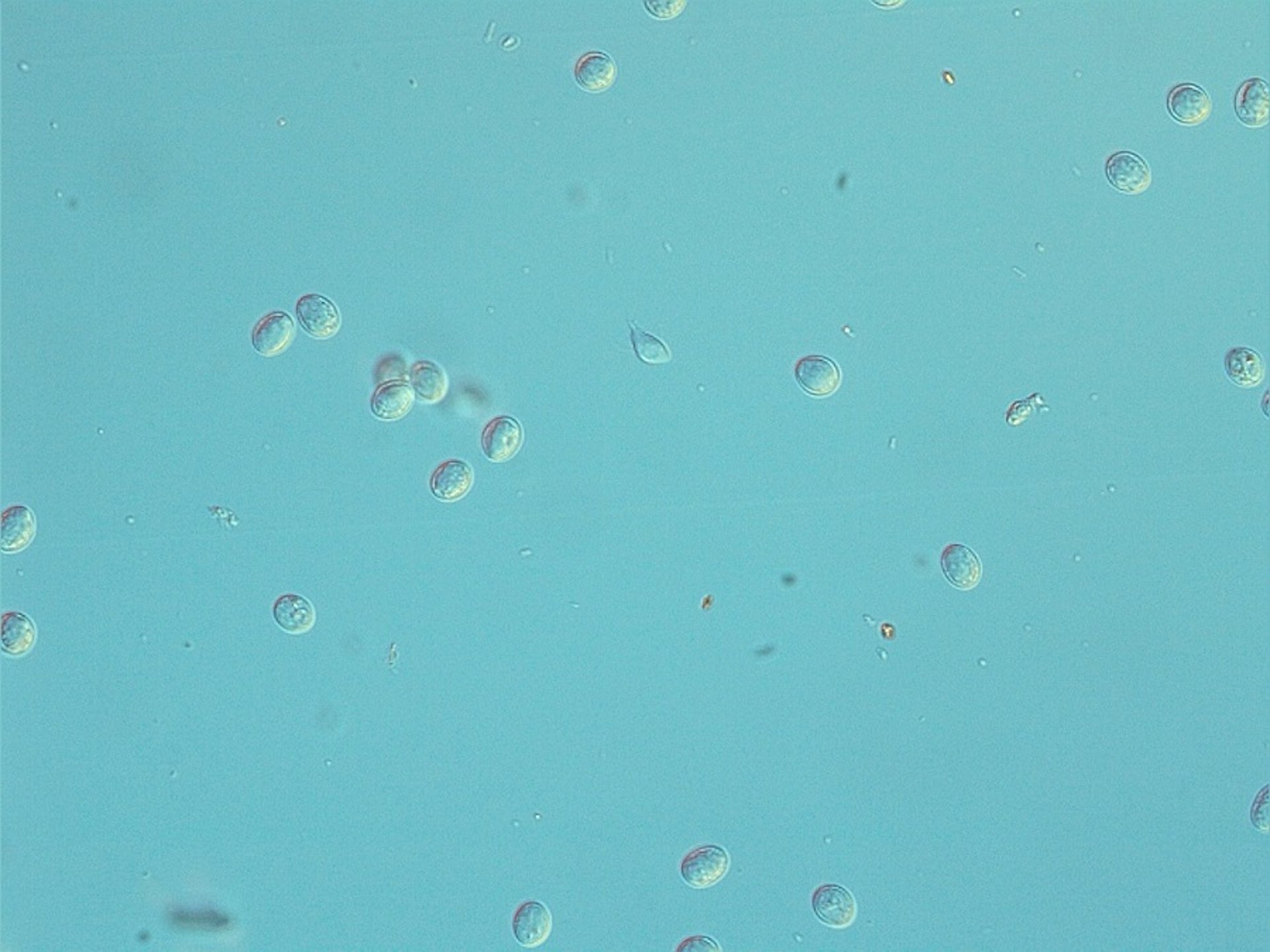 <i >Giardia</i> spp cysts, dog