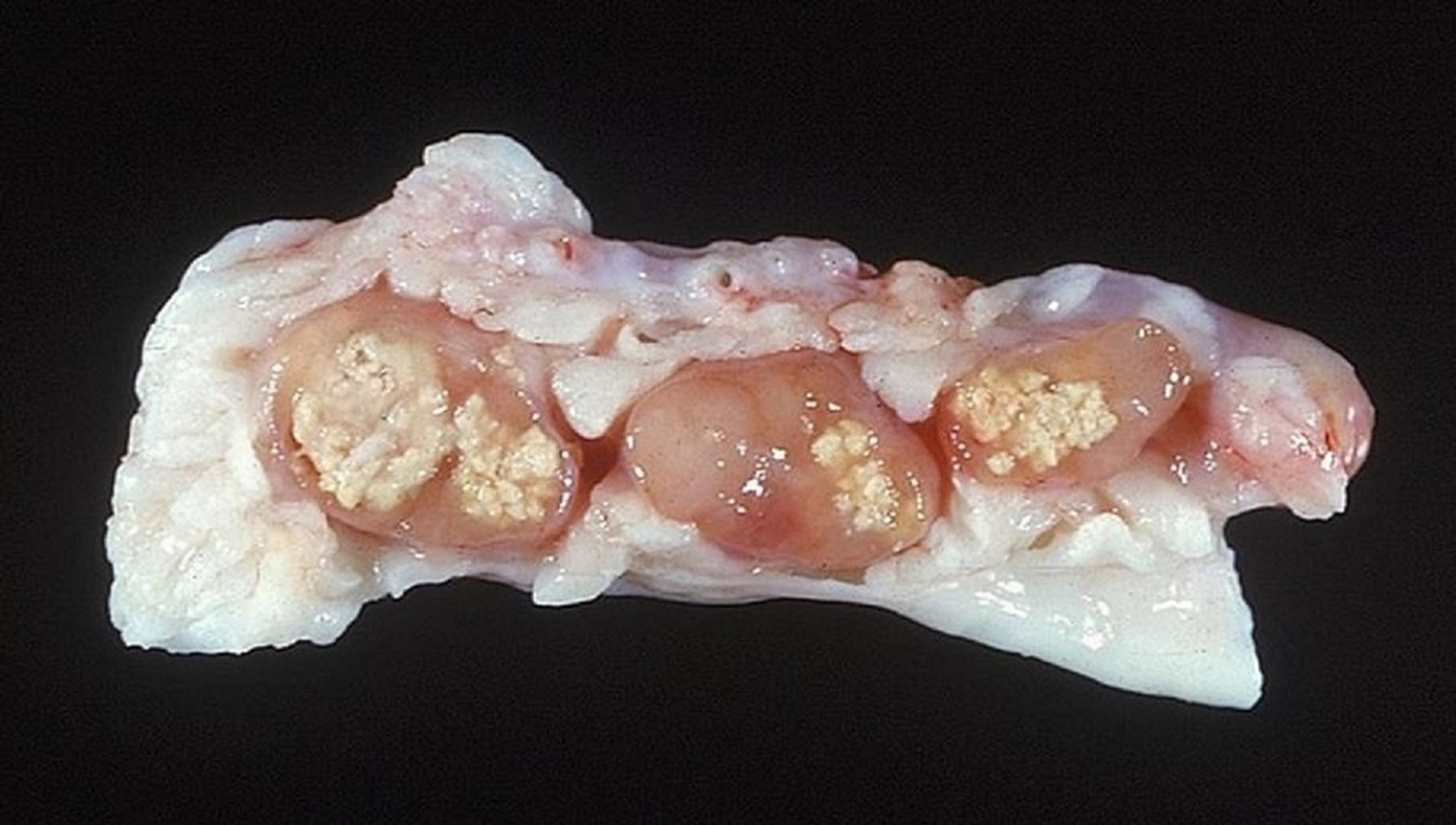 Gross lesions, <i >Mycobacterium avium</i>, lymph node, pig