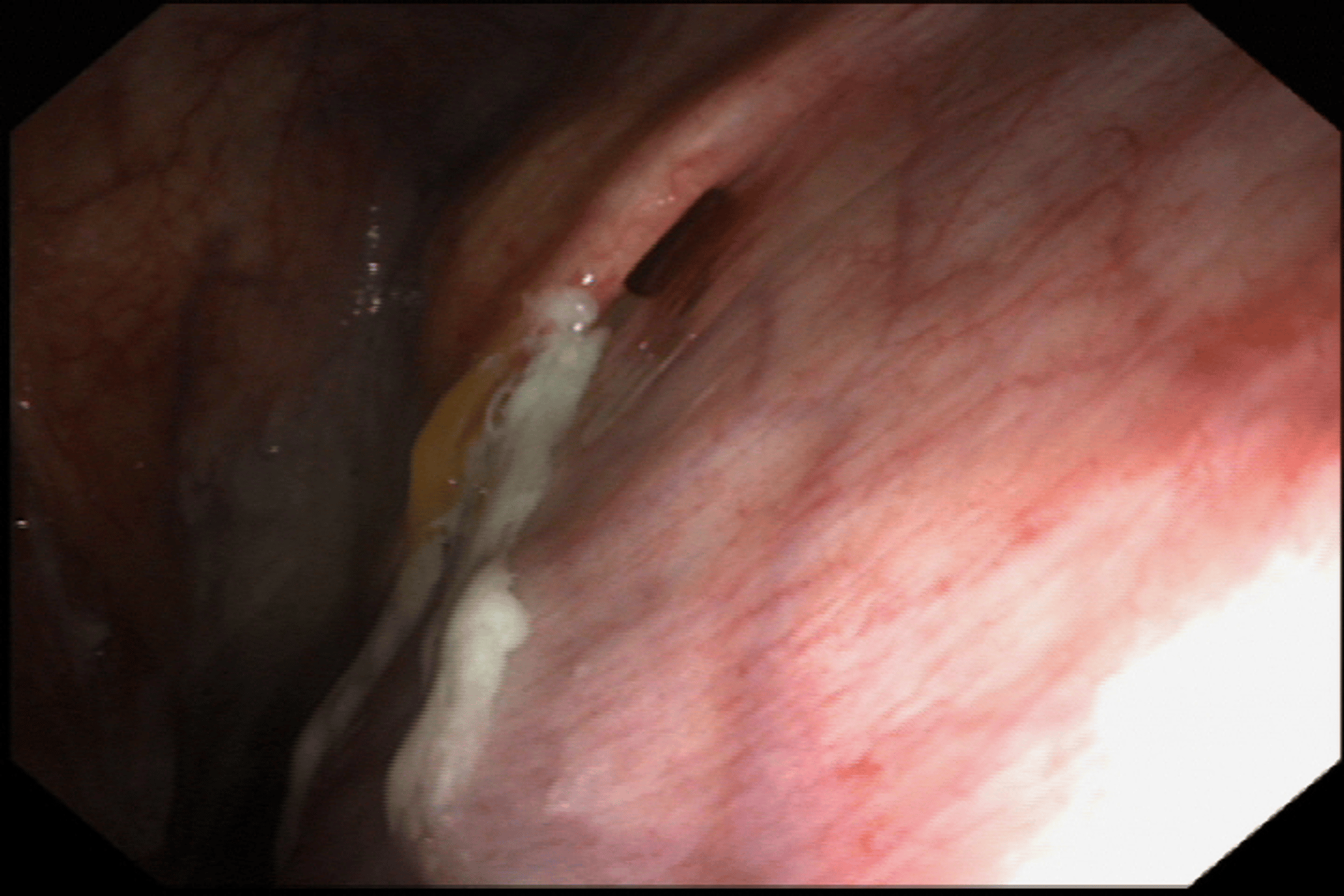 Strangles, horse, pharynx