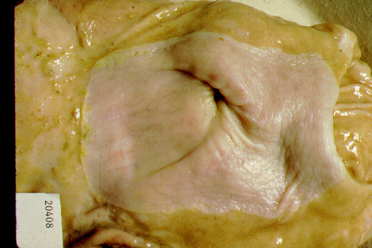 Pars esophagea do estômago de porcos, normal