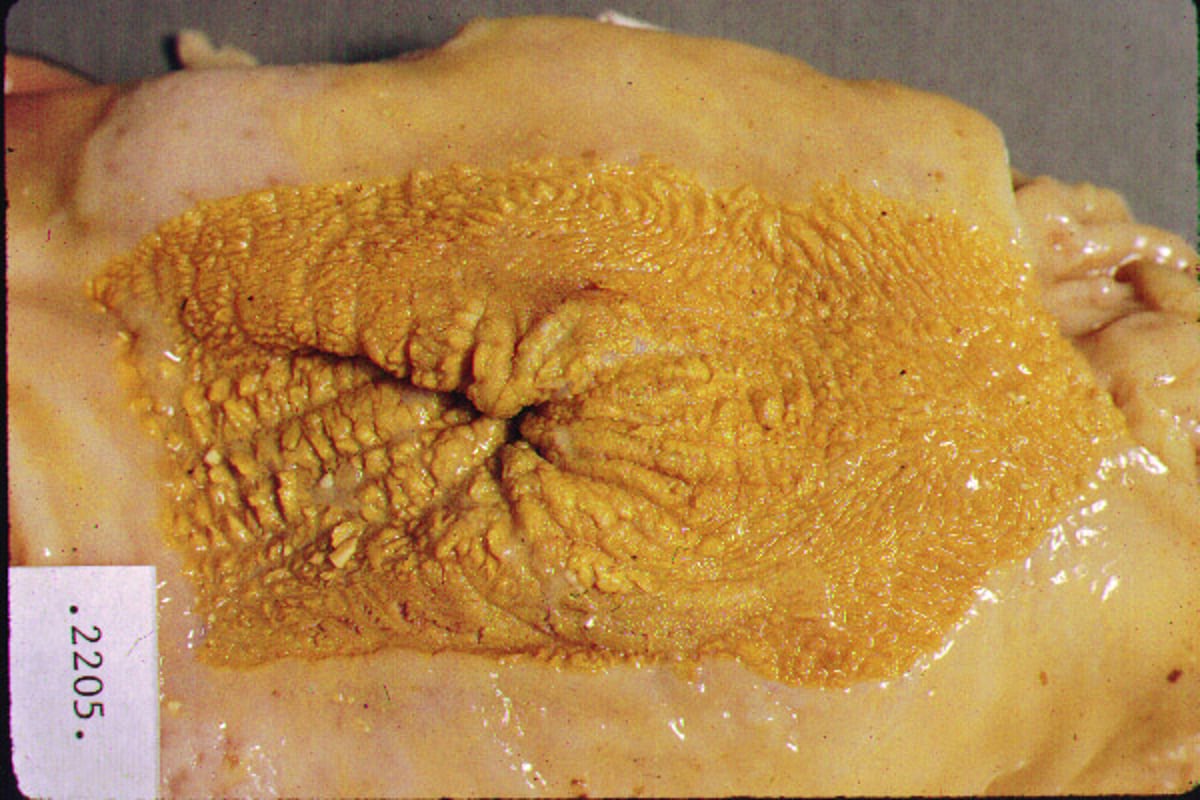 Paraqueratosis por úlcera gástrica, cerdo