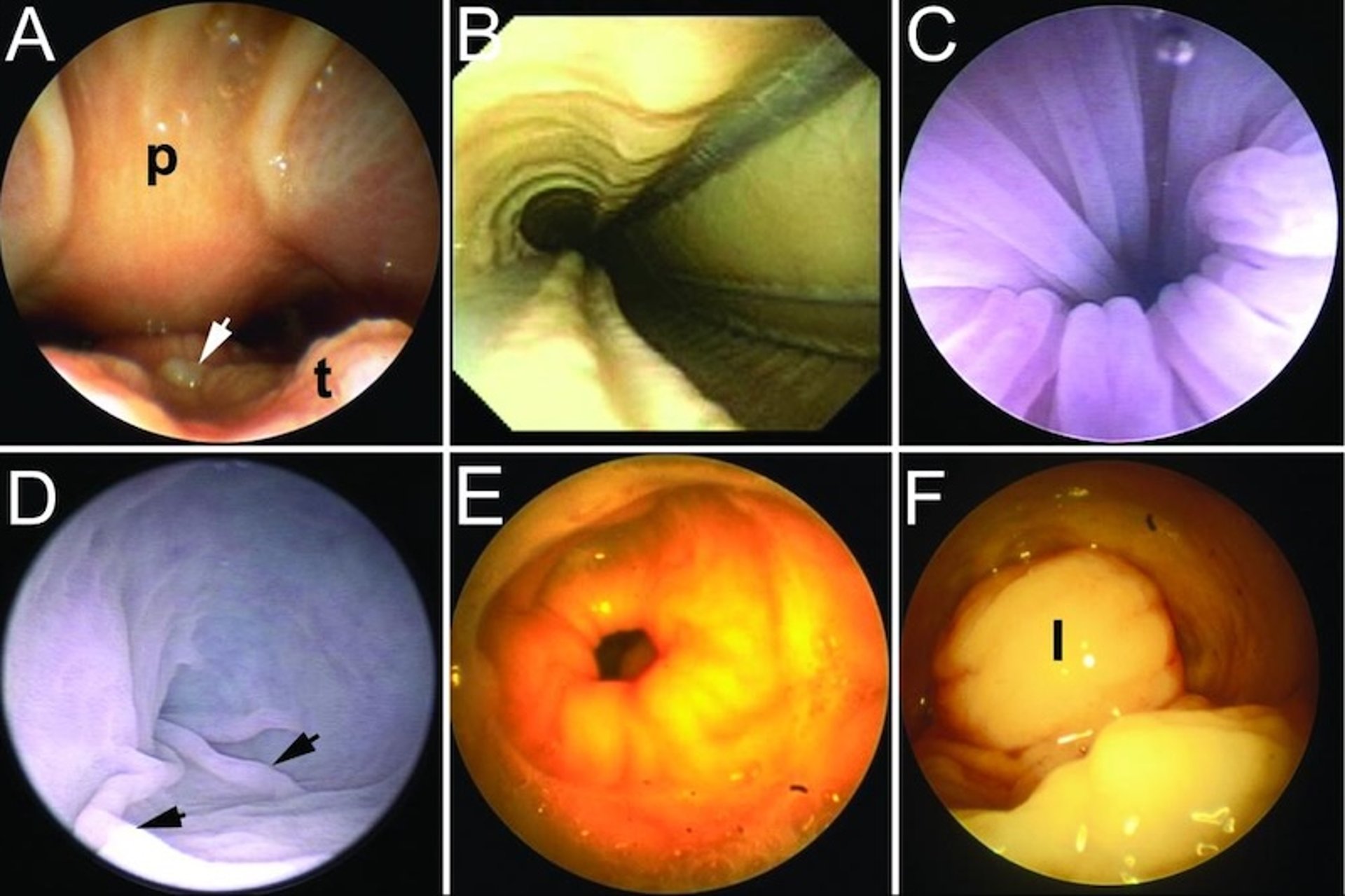 Endoscopia GI, varios reptiles