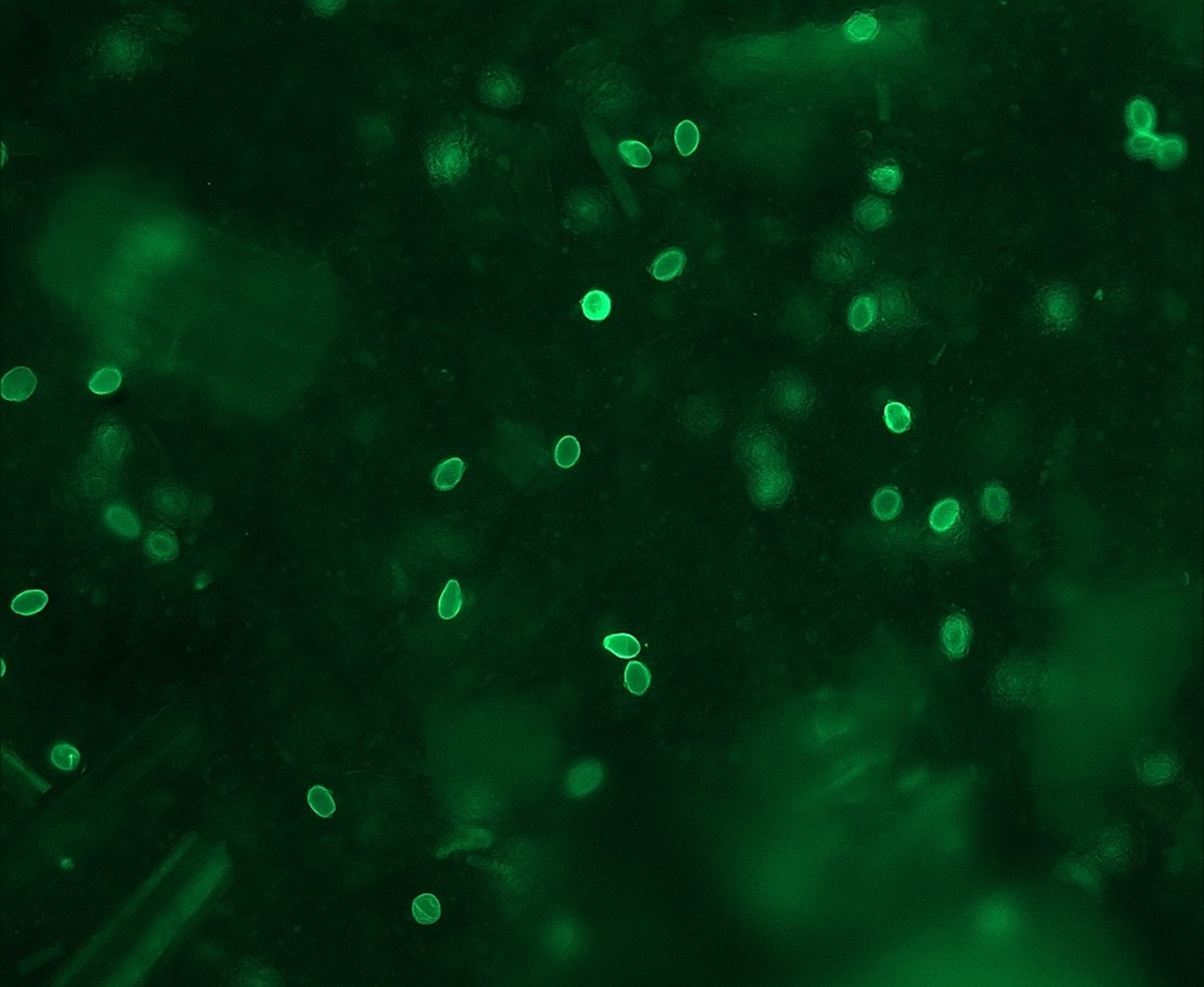 Quistes de <i >Giardia</i> (IFAT)