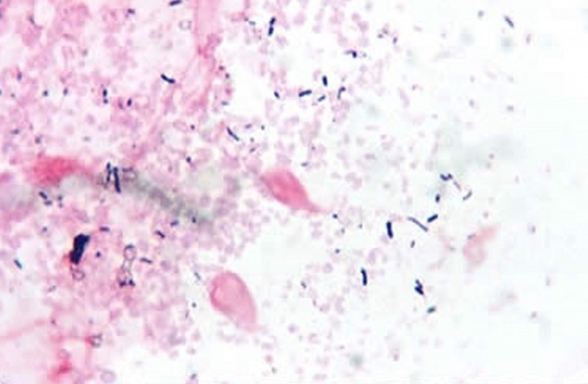 <i >Giardia psittaci</i>, coloração de Gram, intestino delgado de periquito