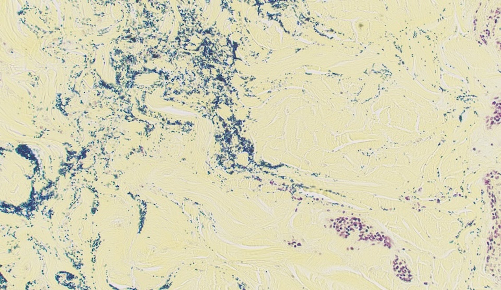 Gram-positive <i >Staphylococcus aureus</i> in tissue, poultry