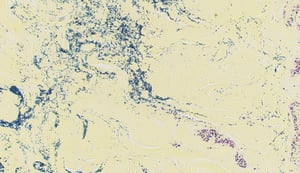 Gram-positive Staphylococcus aureus in tissue, poultry